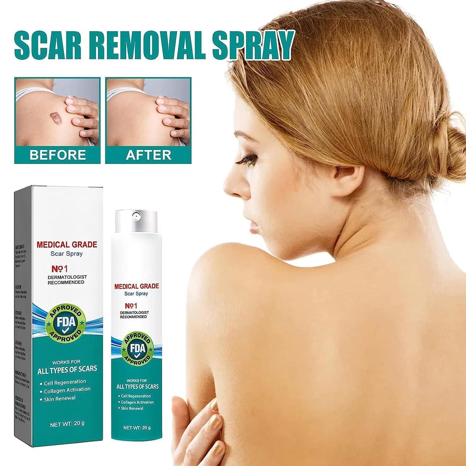South Moon Medical Grade Scar Spray Advanced Scar Removal Treatment