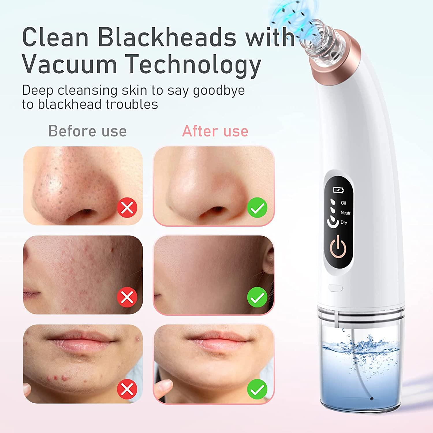 Pores vacuum cleaner sale