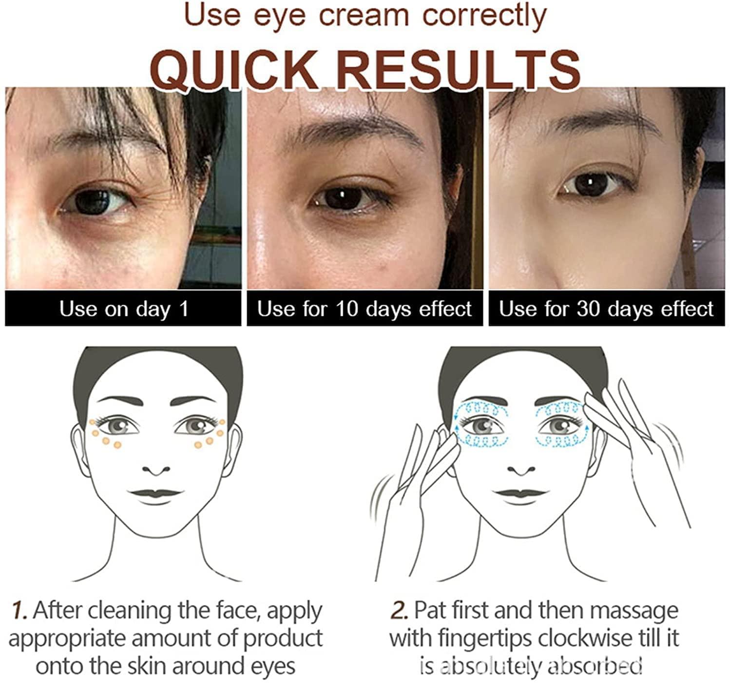 Koxuky 2Pcs Magic Eye Cream - Remove Under Eye Bags, Wrinkles
