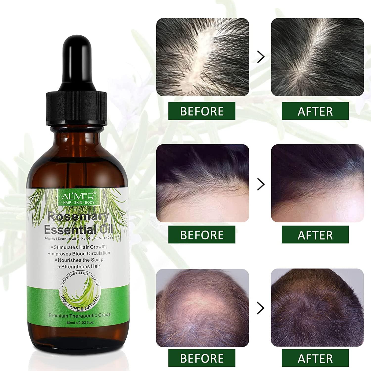 Rosemary Oil for Hair Growth & Skin Care, Rosemary Essential Oil,  Nourishment Scalp, Stimulates Hair Growth,Improves Blood Circulation,Rid of  Itchy & Dry Scalp, Hair Loss Treatment, Rosemary Hair Oil 2.02 Fl Oz (
