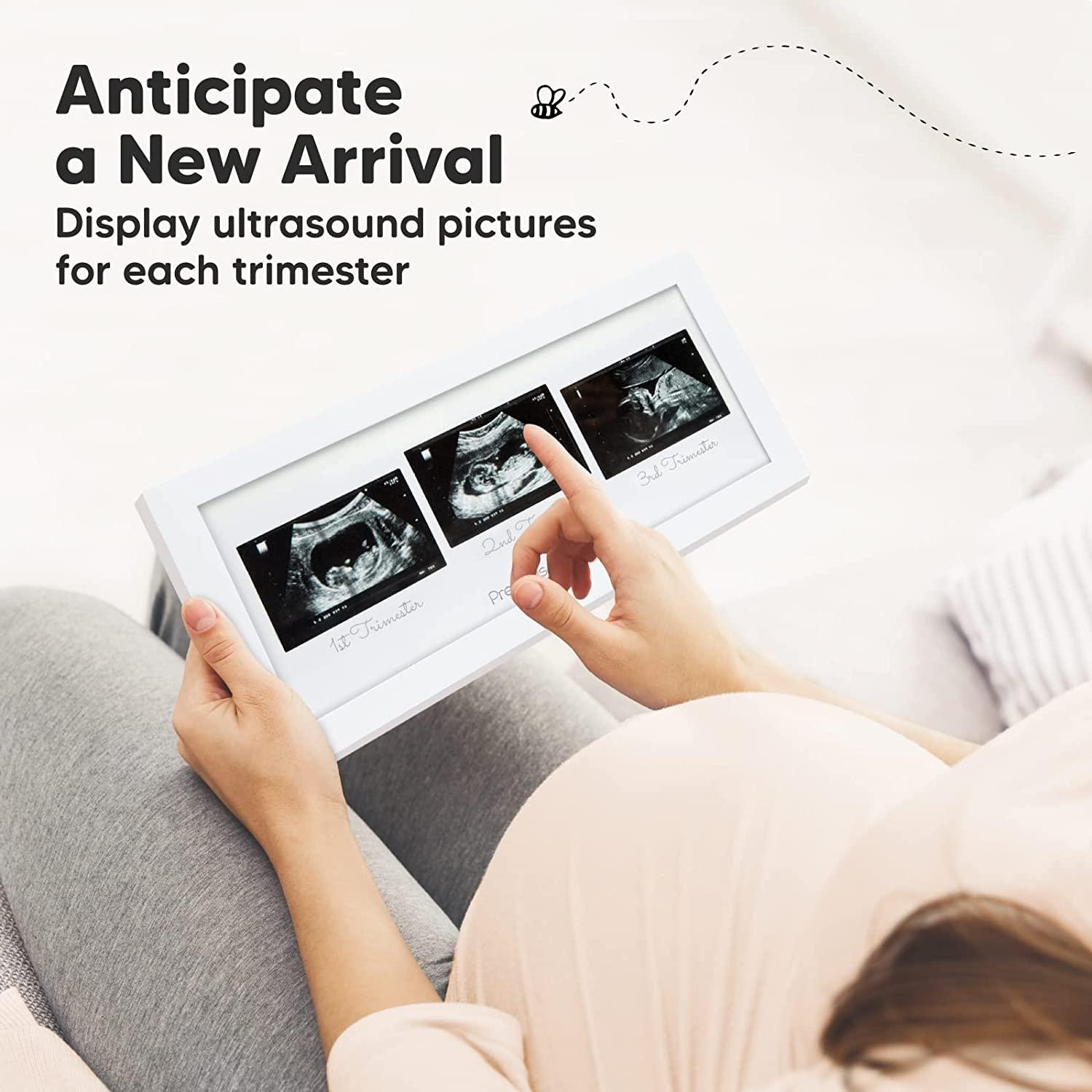 Sonogram Picture Frame Trio Ultrasound Picture Frames For Mom To Be Gift Baby Ultrasound