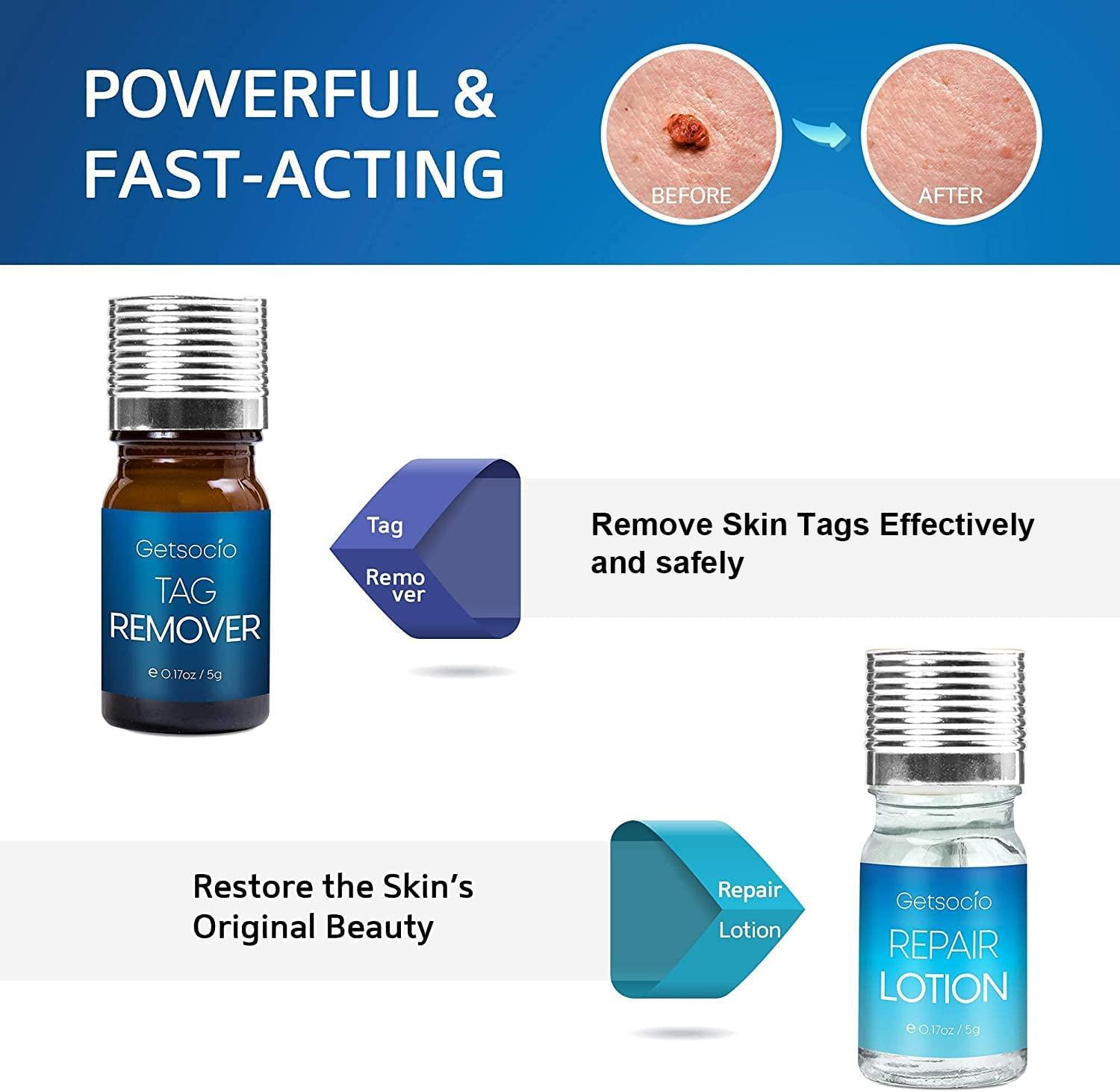 Getsocio Skin Tag & Mole Remover Set Repair Skin, Remove Blemishes