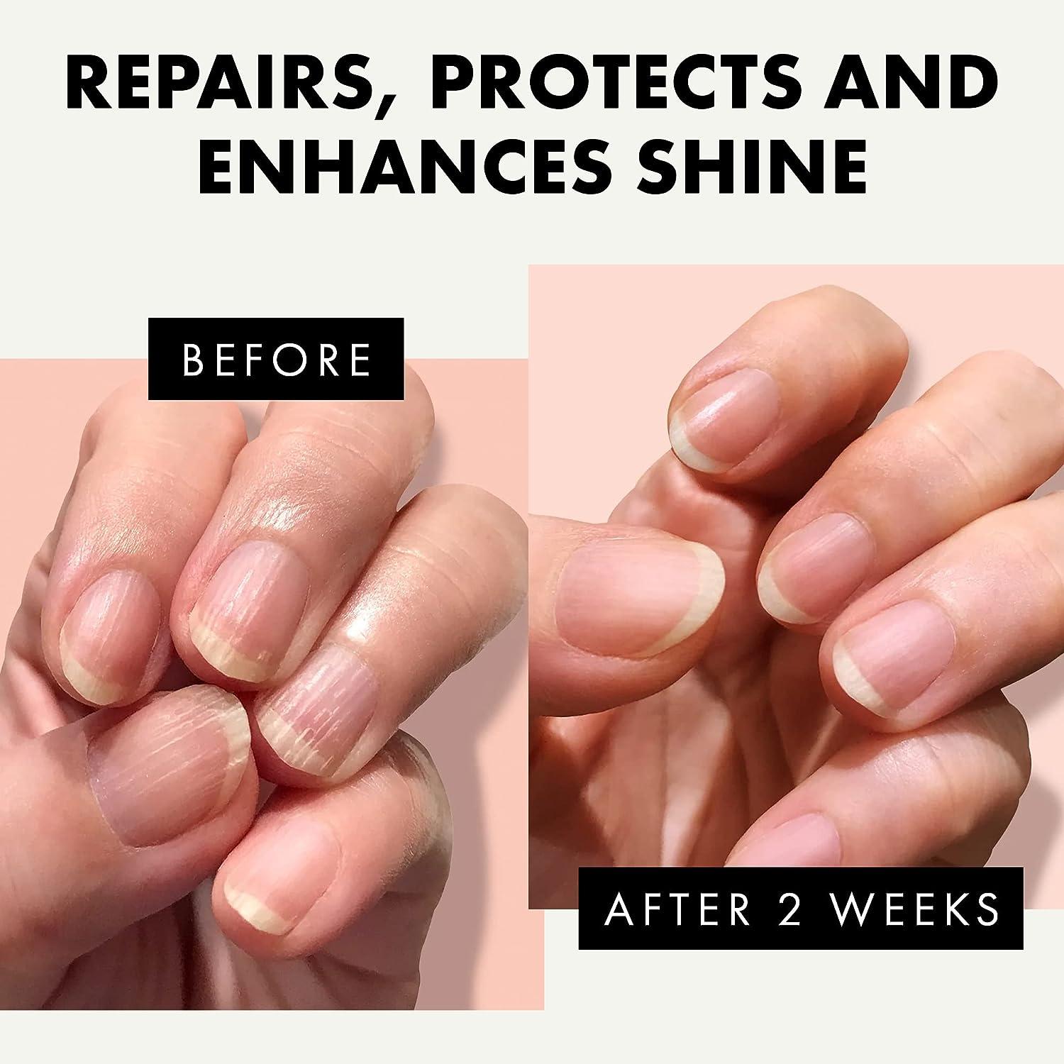 How to fix damaged nails - Quora