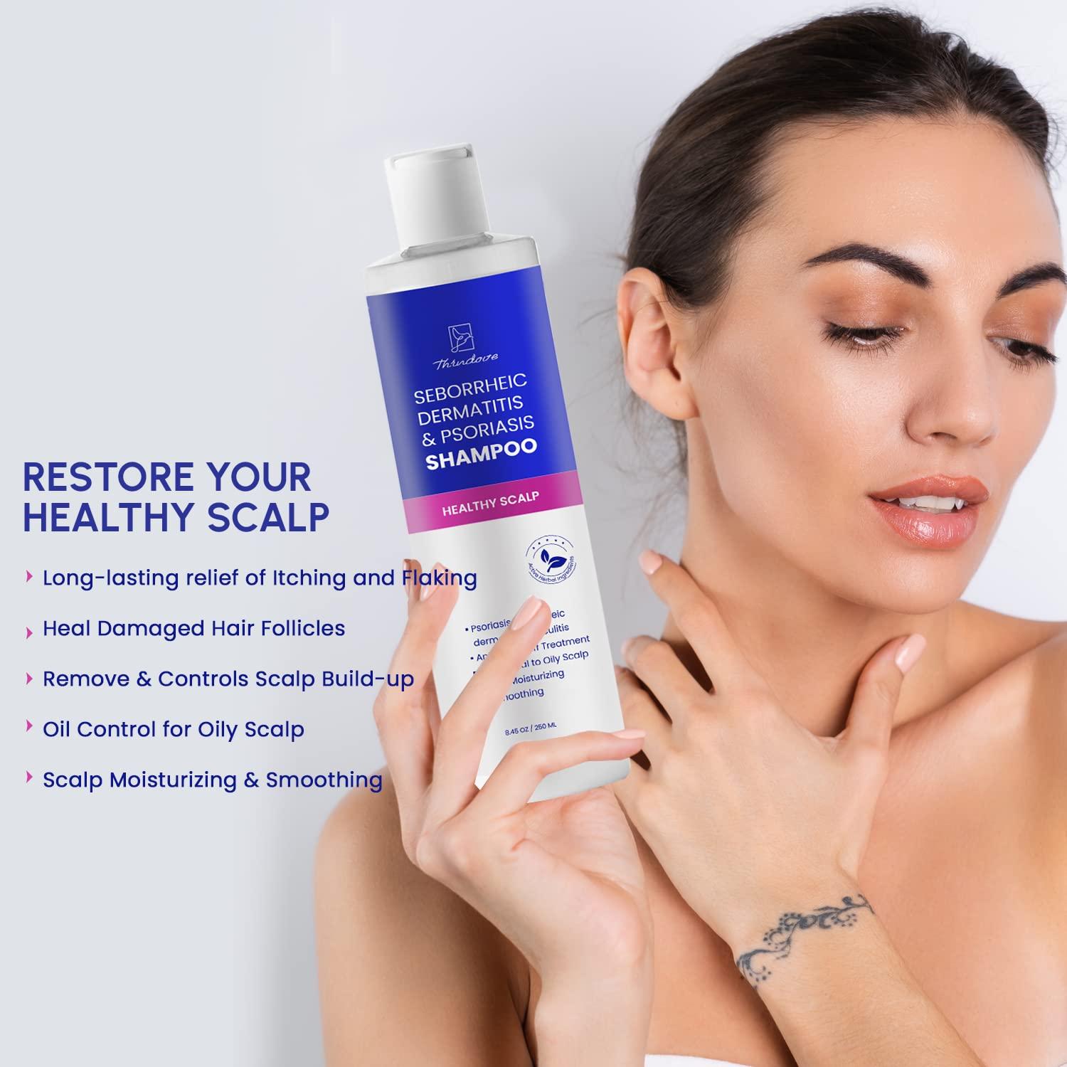 Psoriasis Shampoo Seborrheic Dermatitis Shampoo Dry Scalp Shampoo Itchy