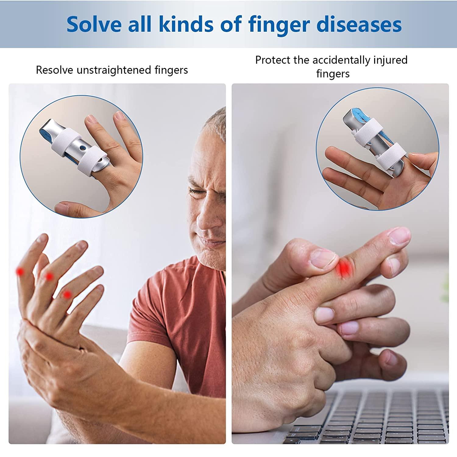 Metal Finger Splint Support Brace for Arthritis, Straightening, and Broken Fingers