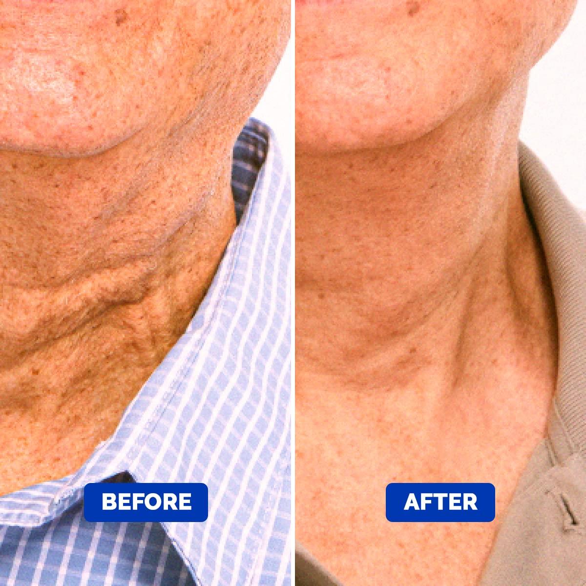 Men's Particle Neck Firming Cream Anti Aging Triple Action with