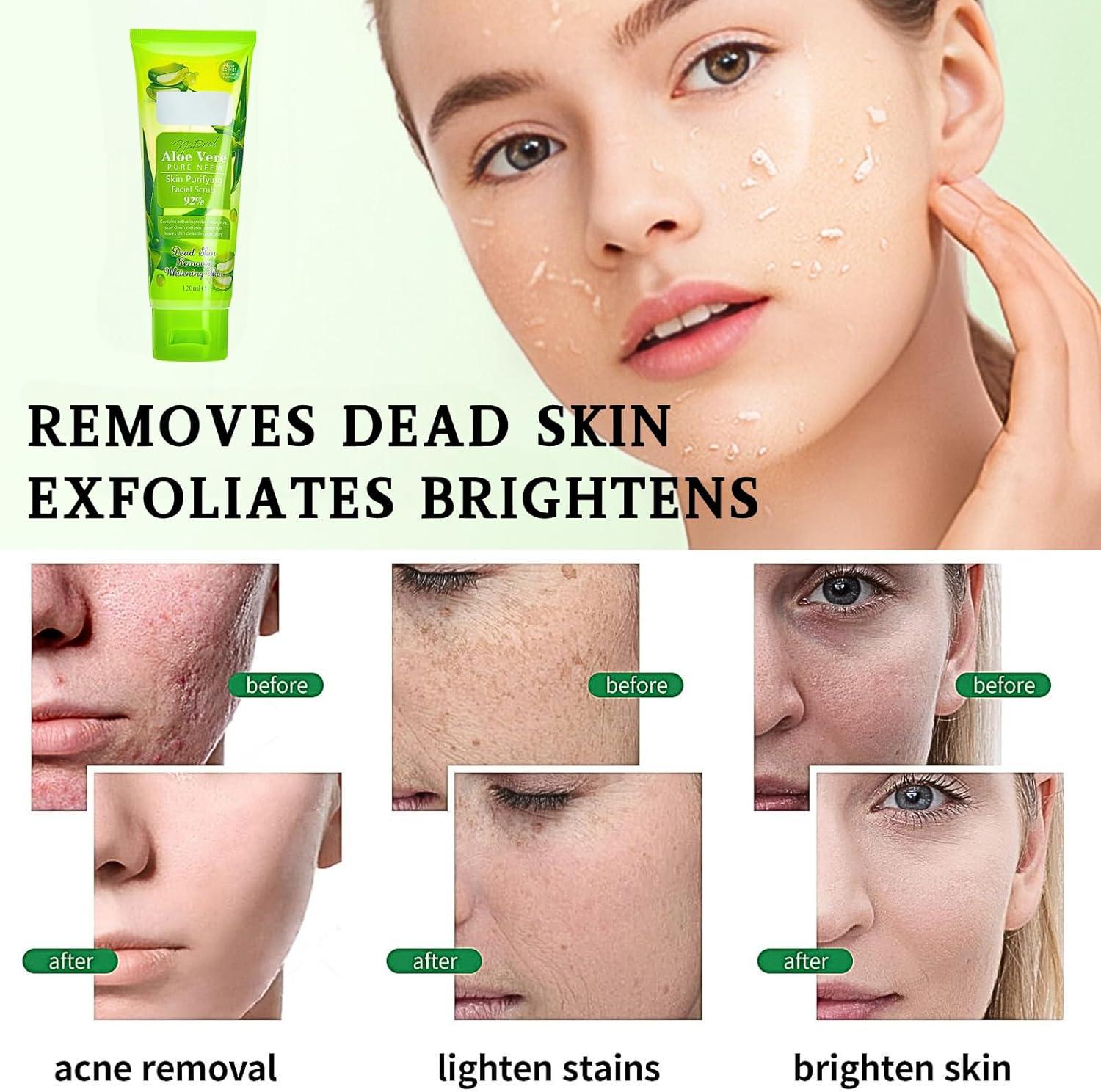 Aloe Vera Facial Scrub Aloe Vera Body Exfoliator Natural Exfoliating Face  Scrub Aloe Vera Gel For Face Scrub Exfoliator Clean Pore Dirt Oil ...