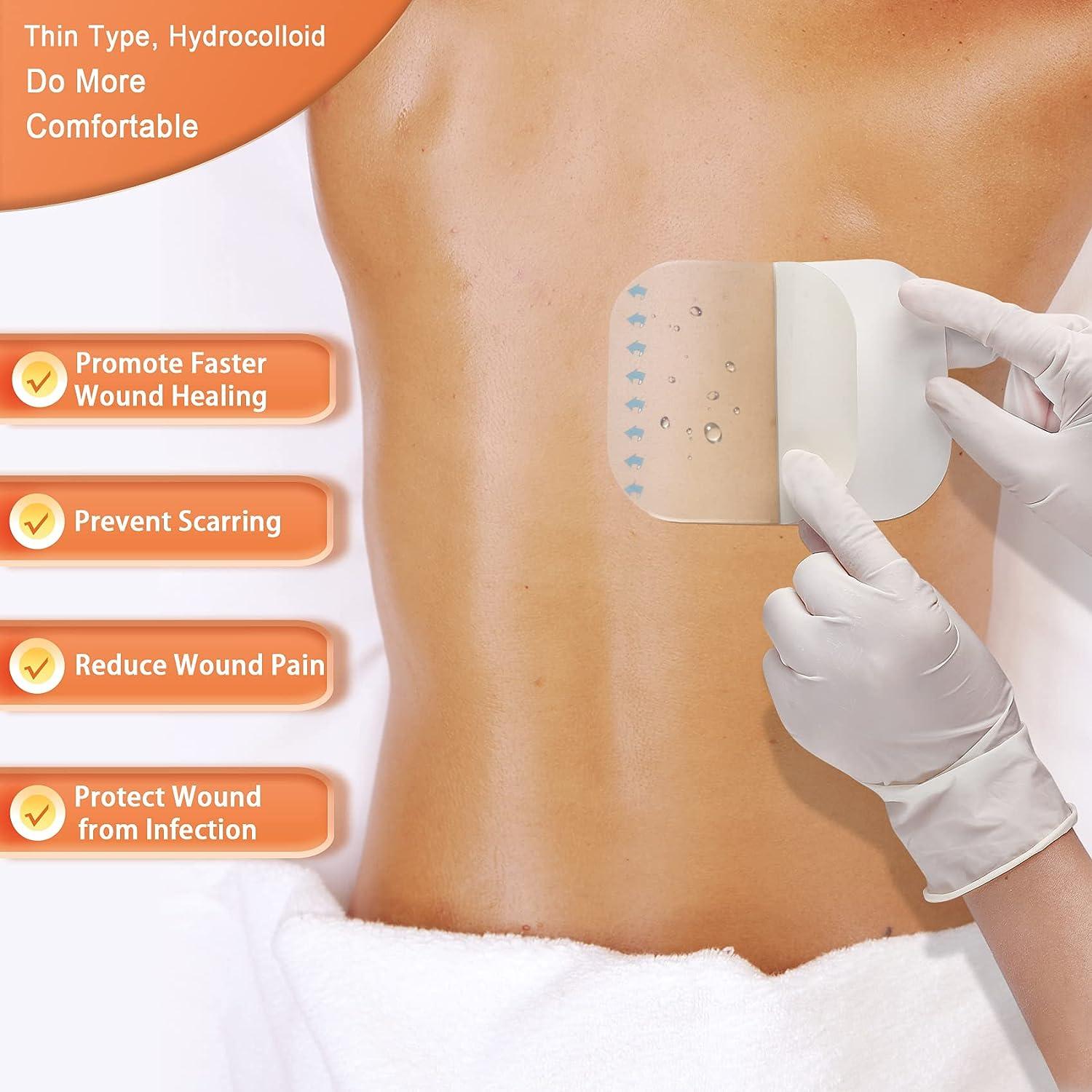 Hydrocolloid Bandage, Hydrocolloid Wound Dressing Thin Type 4'' x 4