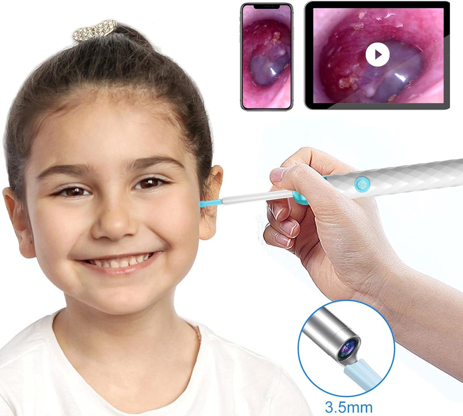 Ear Wax Removal 1080p Full HD Ear CleanerOtoscope with 9 Pcs Ear Set