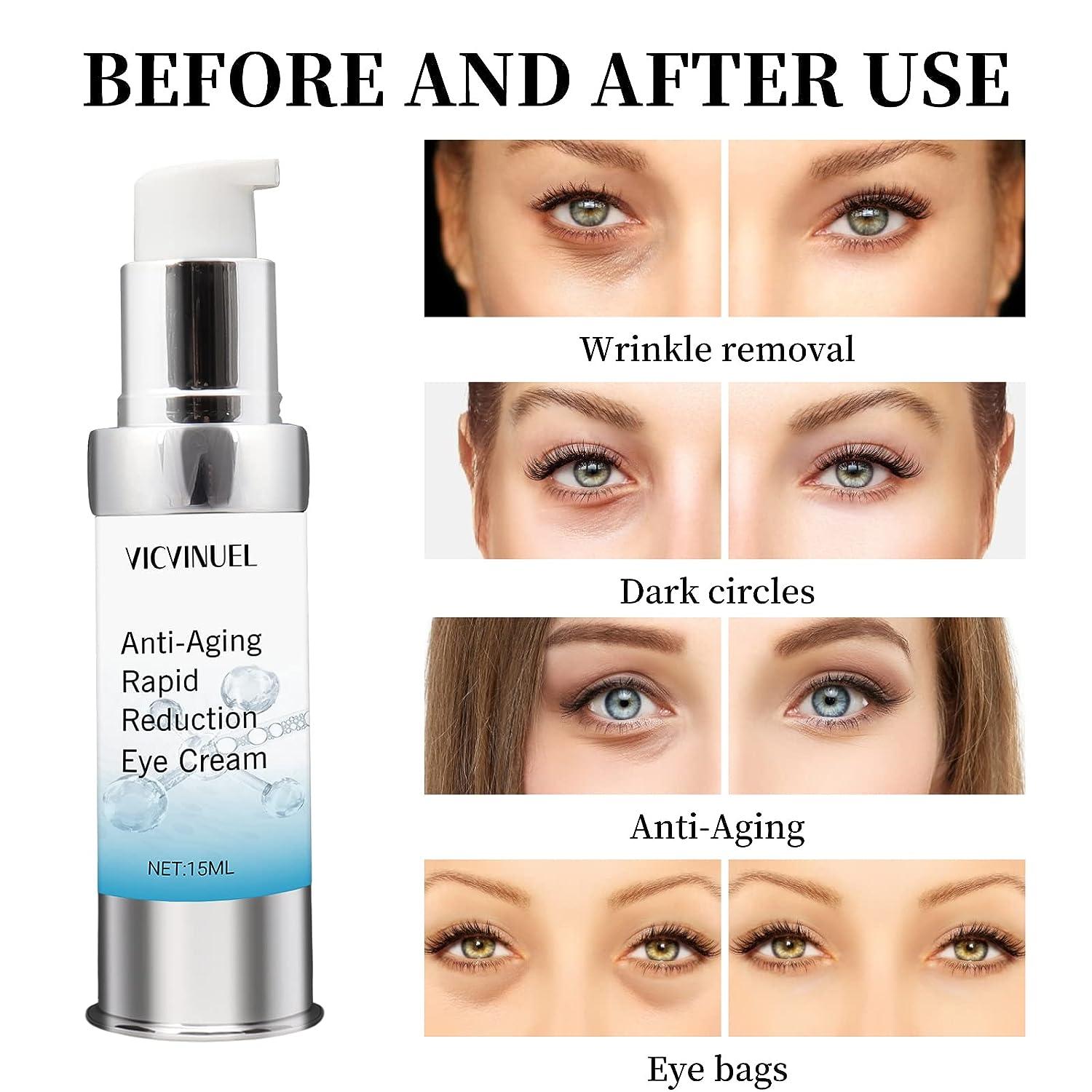 Do Eye Bag Creams Really Work? | Dr. Brett Kotlus, Cosmetic Oculoplastic  Surgeon, NYC