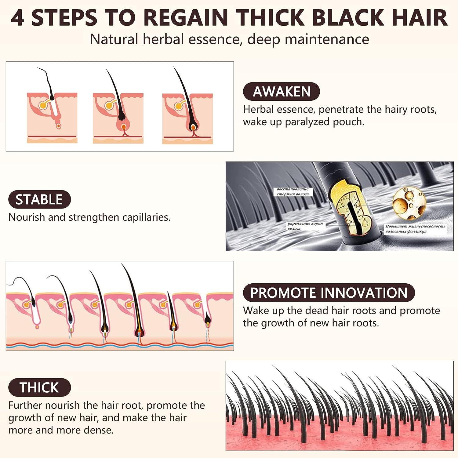 Men's Hair Growth Serum with Biotin 5% Minoxidil - 2.0 oz