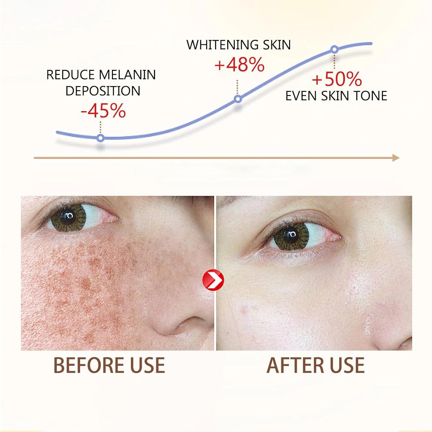 Glutathione Face Cream Freckle Remover Cream Dark Spot Correcting Glow Serum Dark Spot Corrector Correct Black Spots and Brighten the Skin Facial Dark Spots Remover | Buy Now with Express International Delivery | Glutathione Face Cream Freckle Remover Cream Dark Spot Correcting Glow Serum Dark Spot Corrector Correct Black Spots and Brighten the Skin Facial Dark Spots Remover | Buy Now with Express International Delivery |