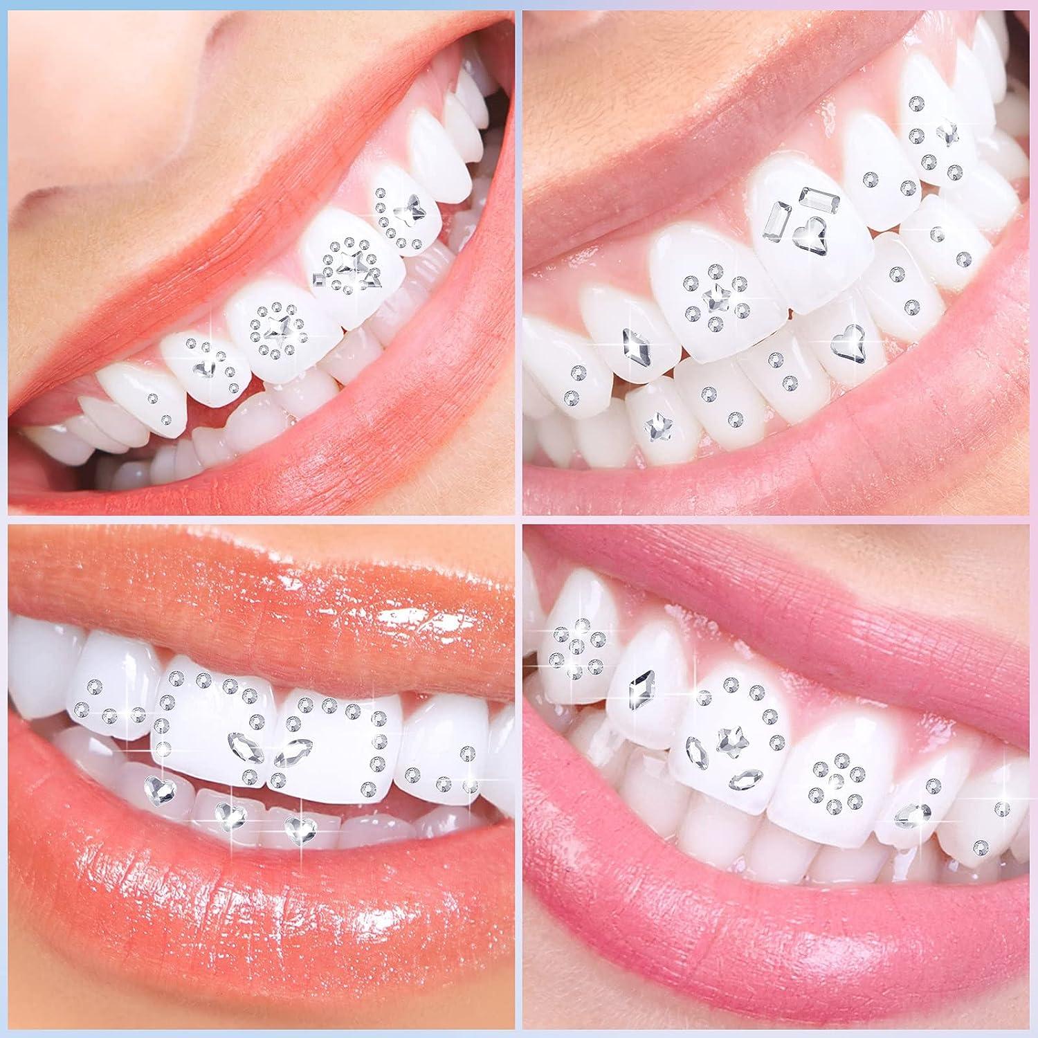  POPETPOP Teeth Jewelry, Tooth Gems Kit, Removable Tooth  Ornaments Teeth Diamond for DIY Tooth Decor Nails Decor 10pcs : Health &  Household
