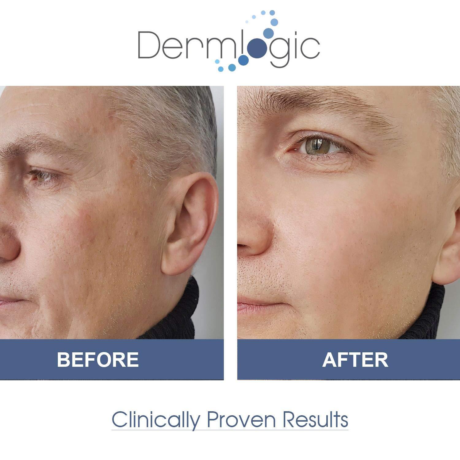 Dark Spot Corrector Cream Visibly Fades & Repairs Marks from Dark