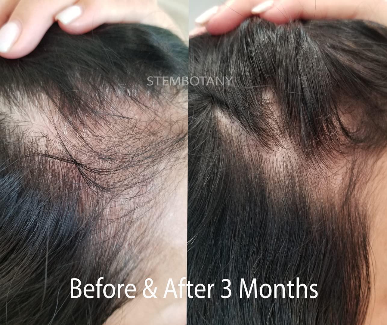 copper peptide ghk-cu hair growth evidence clinical study 7% GHK-Cu Cosmetic Ingredient Accelerant - Skin Biology 15 ml main image 1