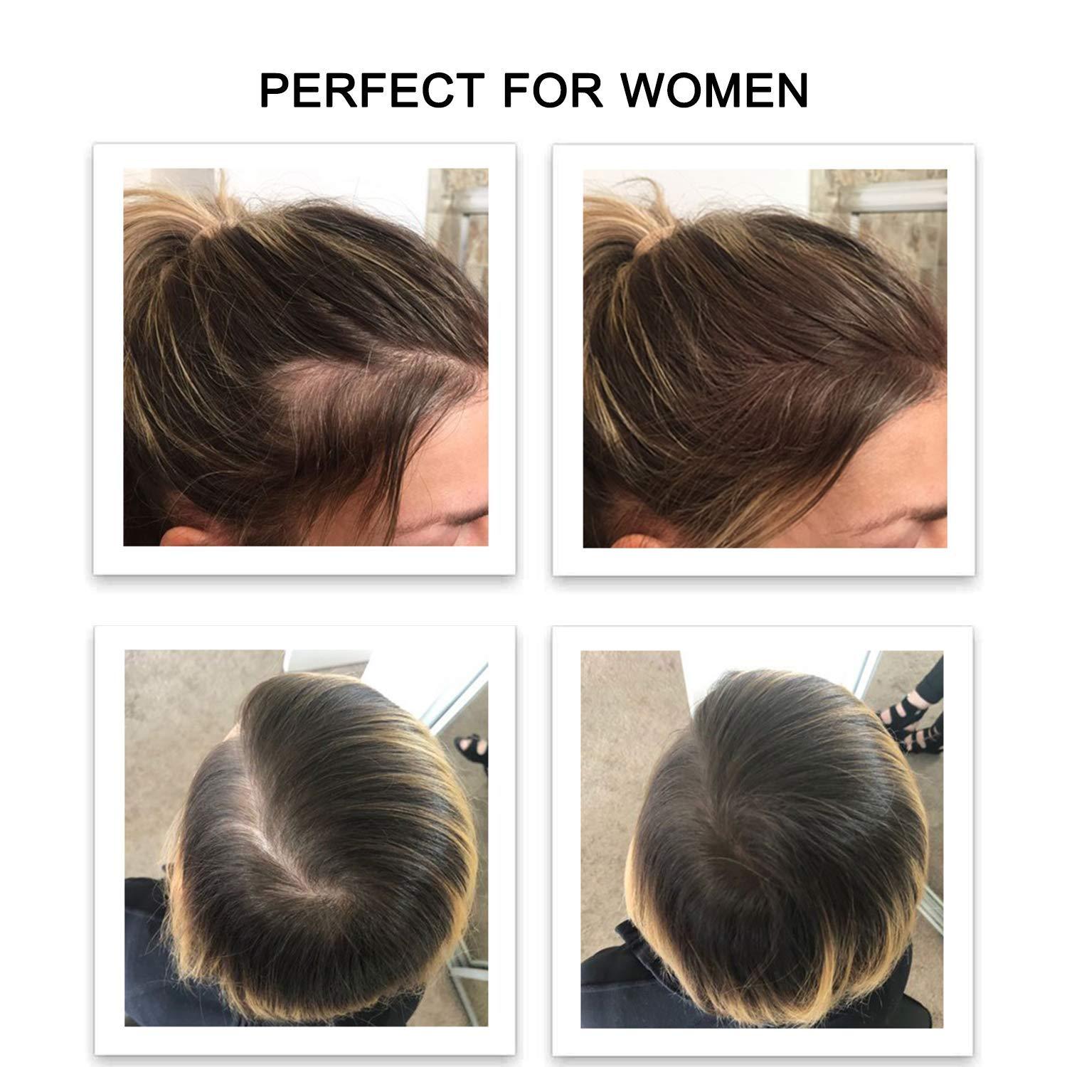 FEBRON Hair Fibers For Thinning Hair MEDIUM BROWN Giant 30G For Women & Men  Hair Loss Concealer Hair Powder Volumizing Based 100% Undetectable &  Natural - Bold Spots Filler  Ounce (Pack