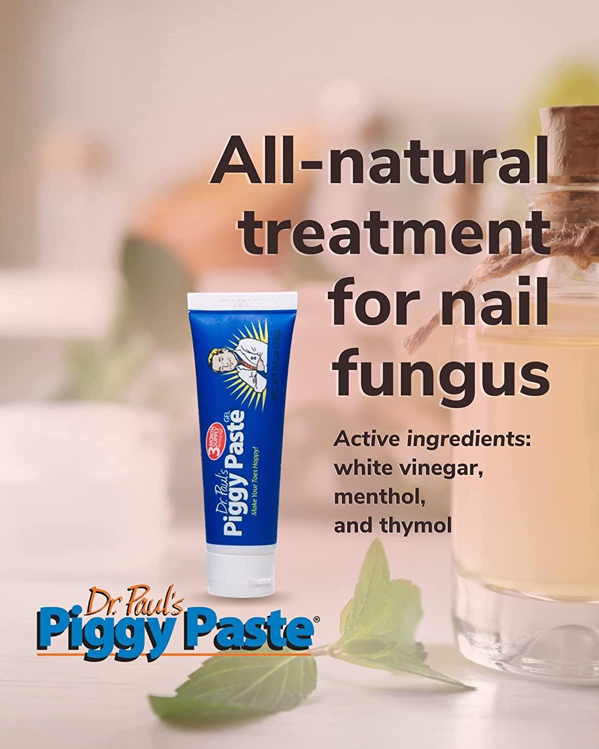 10 Natural Remedies to Fight Back Against Toenail Fungus | by Vyndle Net |  Mar, 2024 | Medium