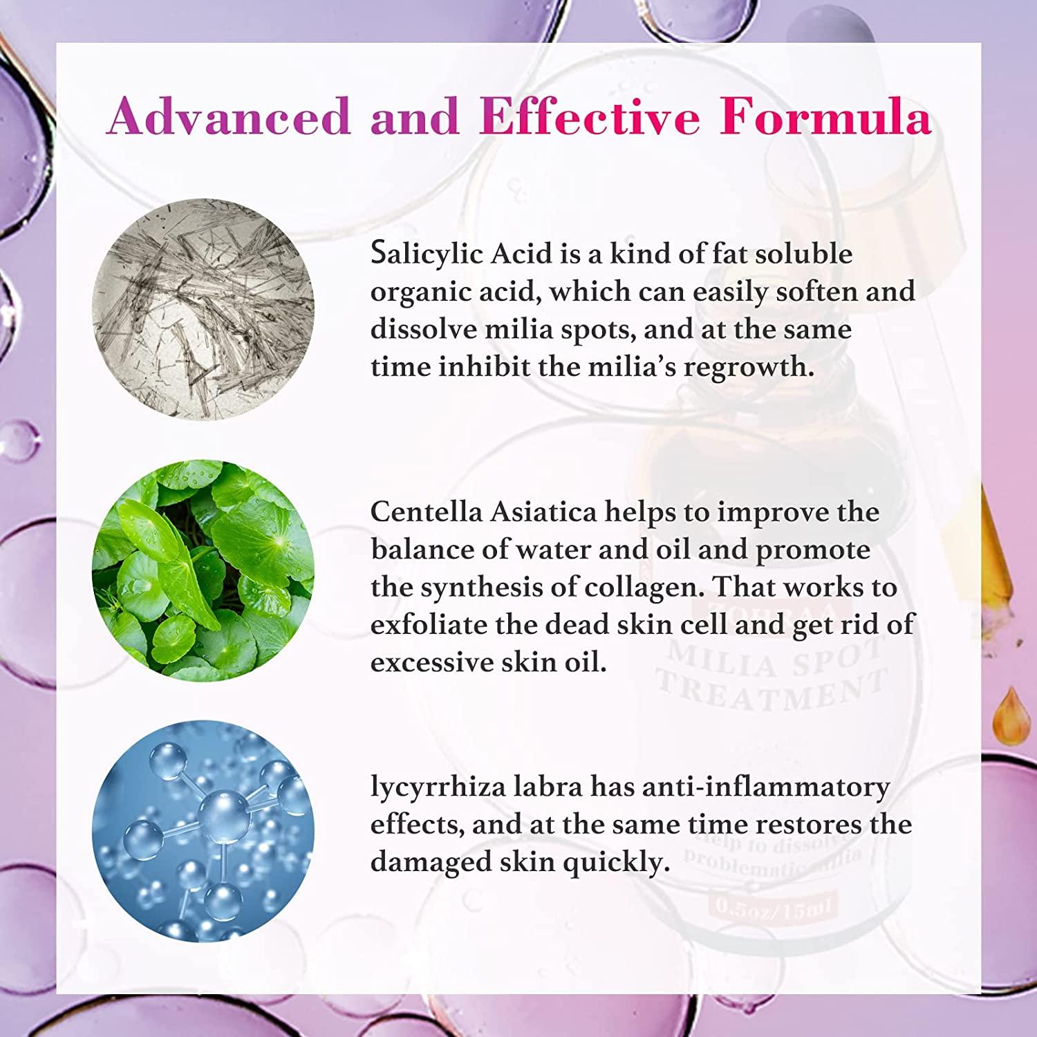 ZOHRAA Milia Remover Milia Spot Treatment Helps Dissolve and Reduce