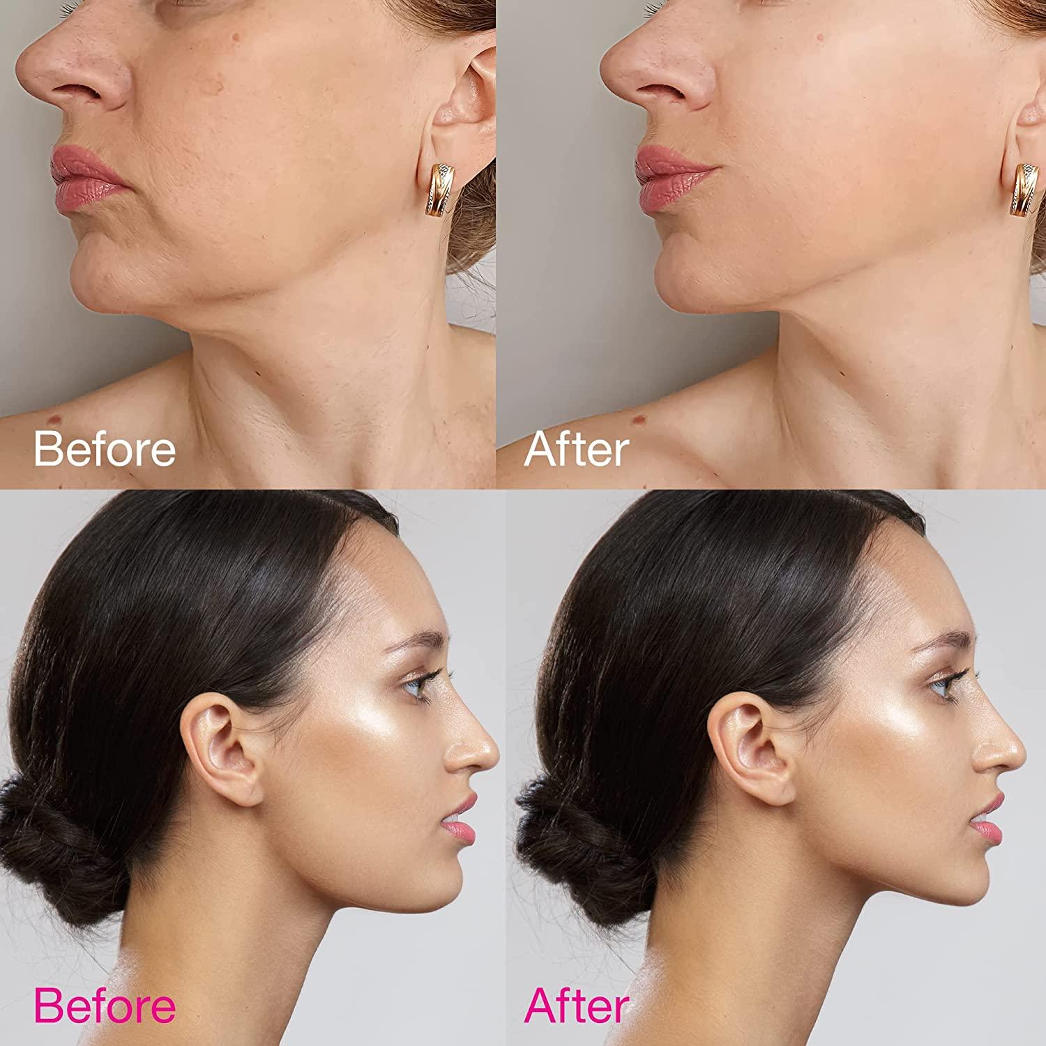 Galeboy V line Lifting Mask Double Chin Reducer, Double Chin Eliminator