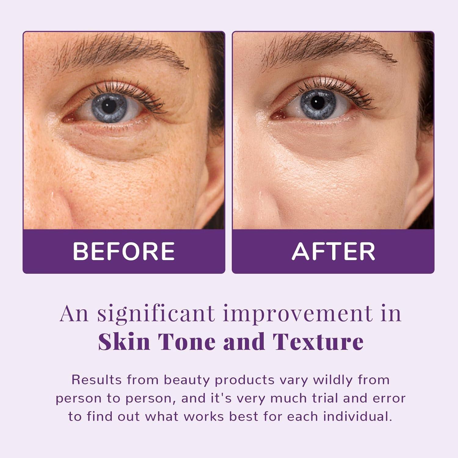 ANAiRUi Niacinamide Toner Pad | Glutathione Niacinamide PHA & LHA |  Exfoliating Facial Pads for Exfoliation Even Skin Tone 50 Pads | Buy Now  with Express International Delivery