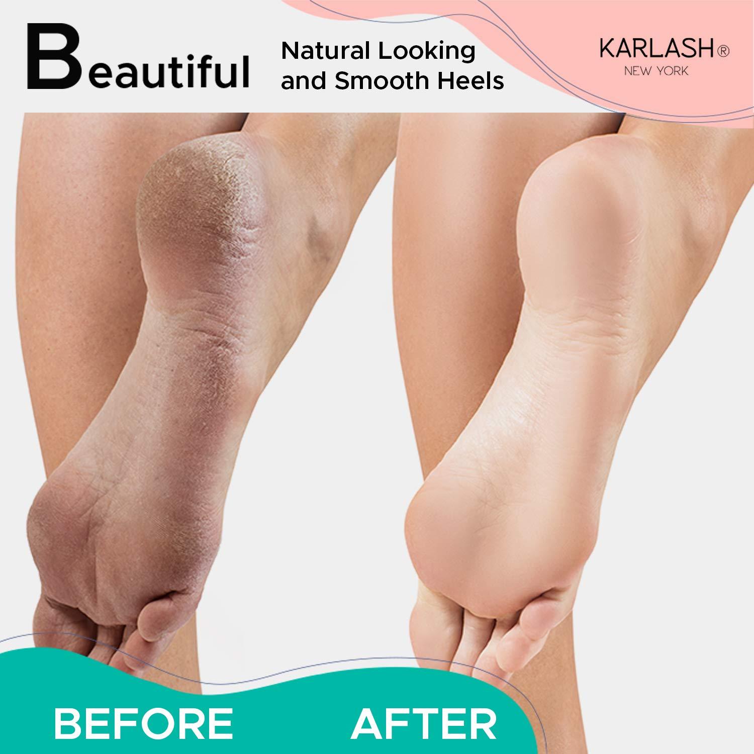 Karlash Professional Pedicure Foot Pumice Stone for Feet Skin Callus