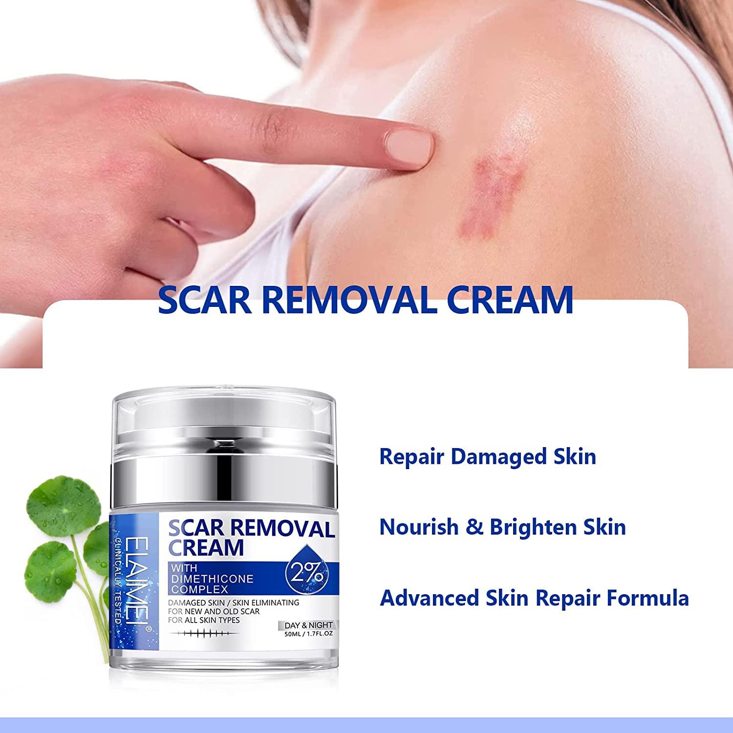 2022 Upgraded Scar Removal Cream - Advanced Treatment Gel for Surgical ...