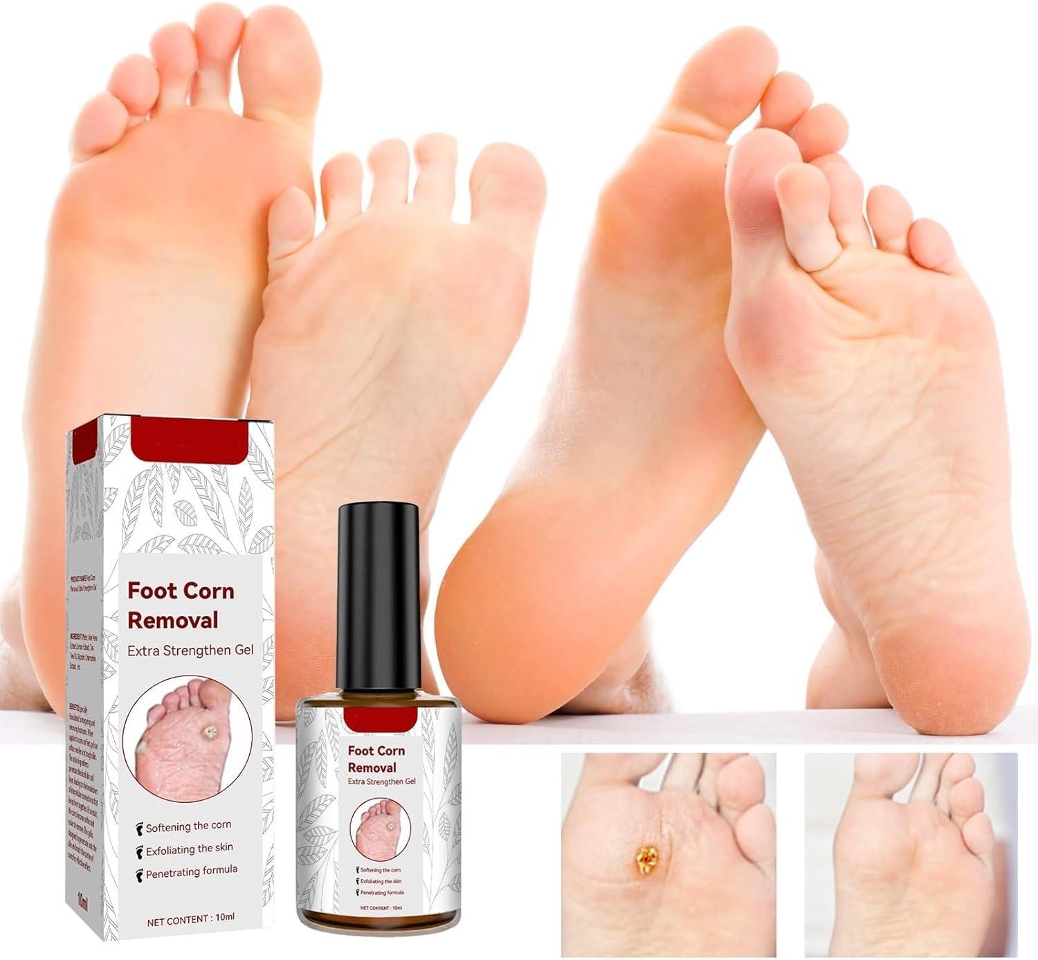 RZAJJN GFOUK Foot Corn Removal Extra Strengthen Gel 10ml Corn Removal