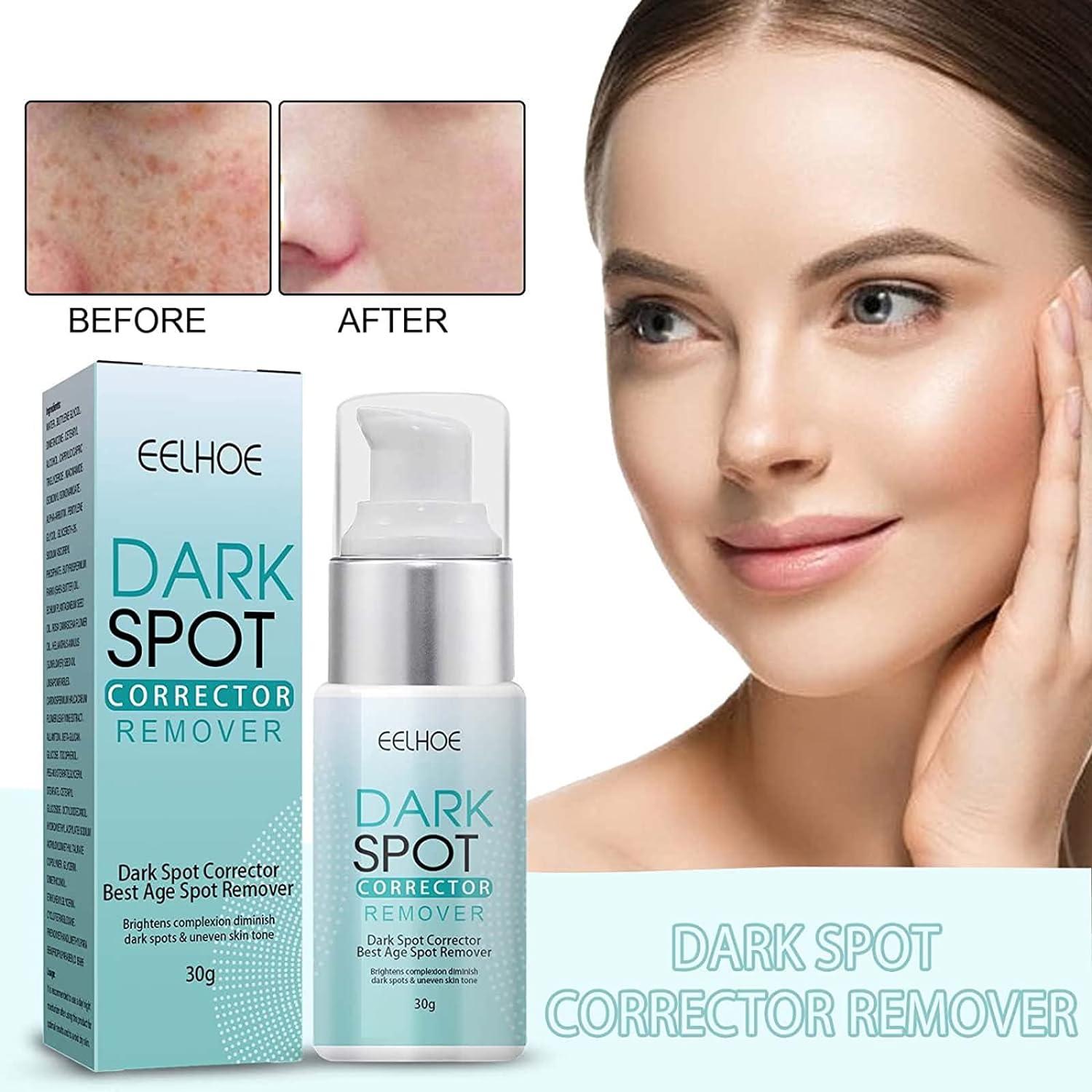 Best cream for removing dark hot sale spots