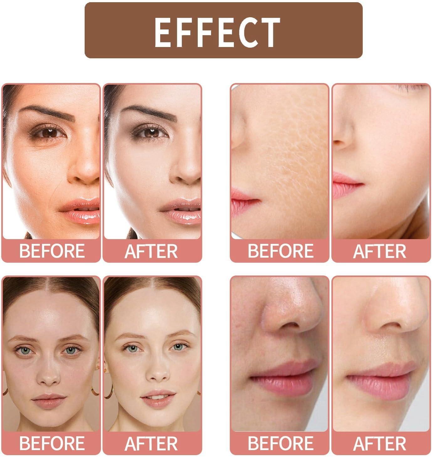 best s acetyl glutathione Glutathione Face Cream Glutathione Anti-Aging Face Cream for Women & Men  Glutathione Hydrating & Whitening Cream Dark Spot Remover for Face Skin  Brightener Cream Face Moisturiser Skin Care Moisturizer