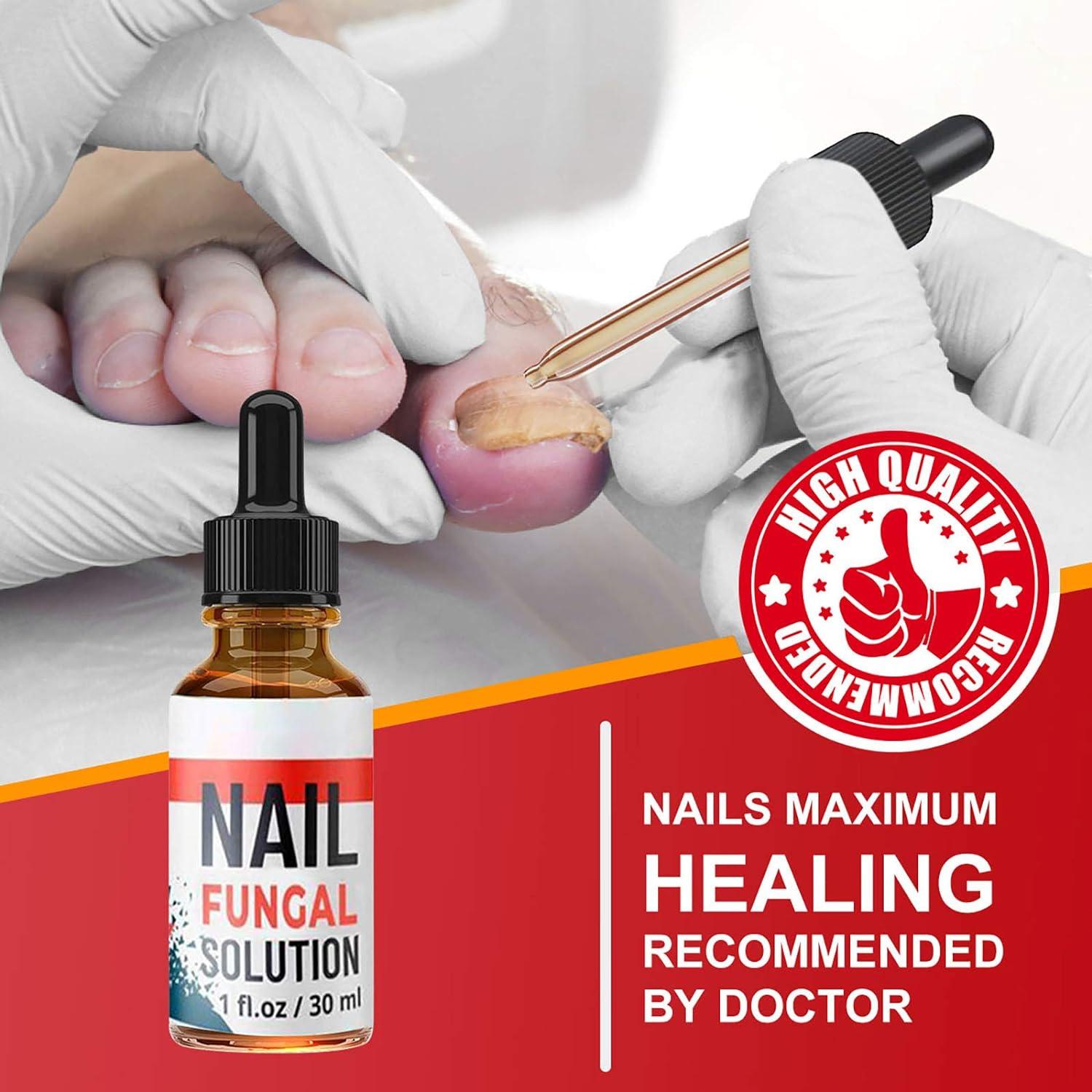 WERPOWER Fungal Nail Treatment Fungal Nail Treatment for Toenails Extra