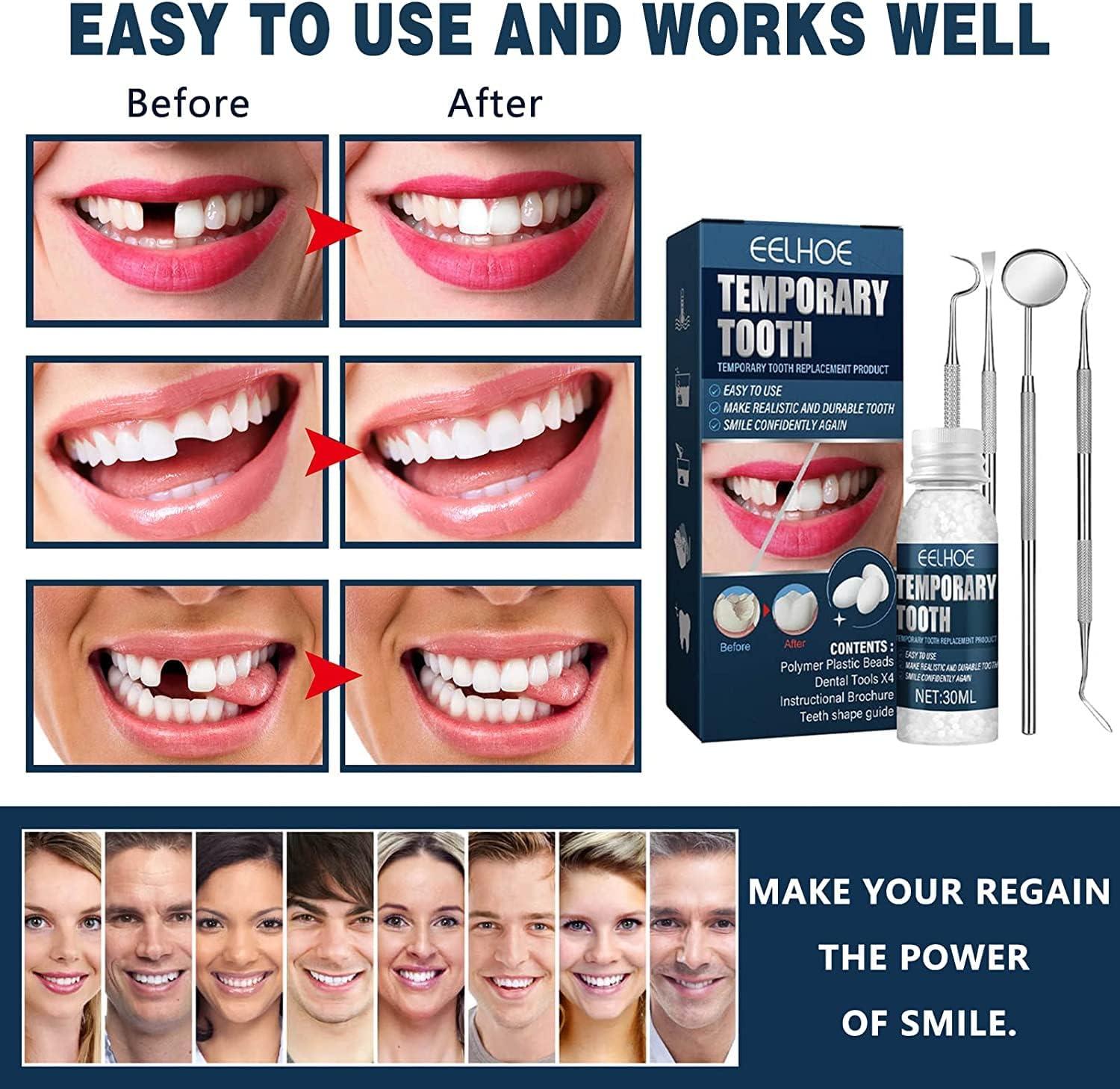 Ganbaro Moldable False Teeth, Teeth Repair Kit, Tooth Repair Granules, Temp  Tooth Beads with 4 Dental Tools, Snap On Instant and Confident Smile