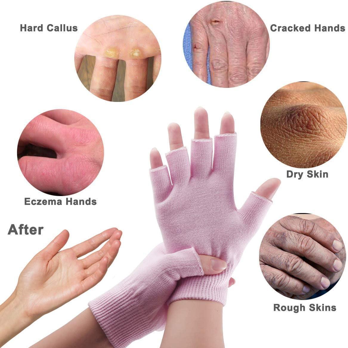 Moisturizing Gloves, Soft Silicone Gloves, Gel Spa Hydrating Gloves, Aloe  Lotion Gloves for Repairing Dry Cracked, Aging Hands, Eczema, and Softening