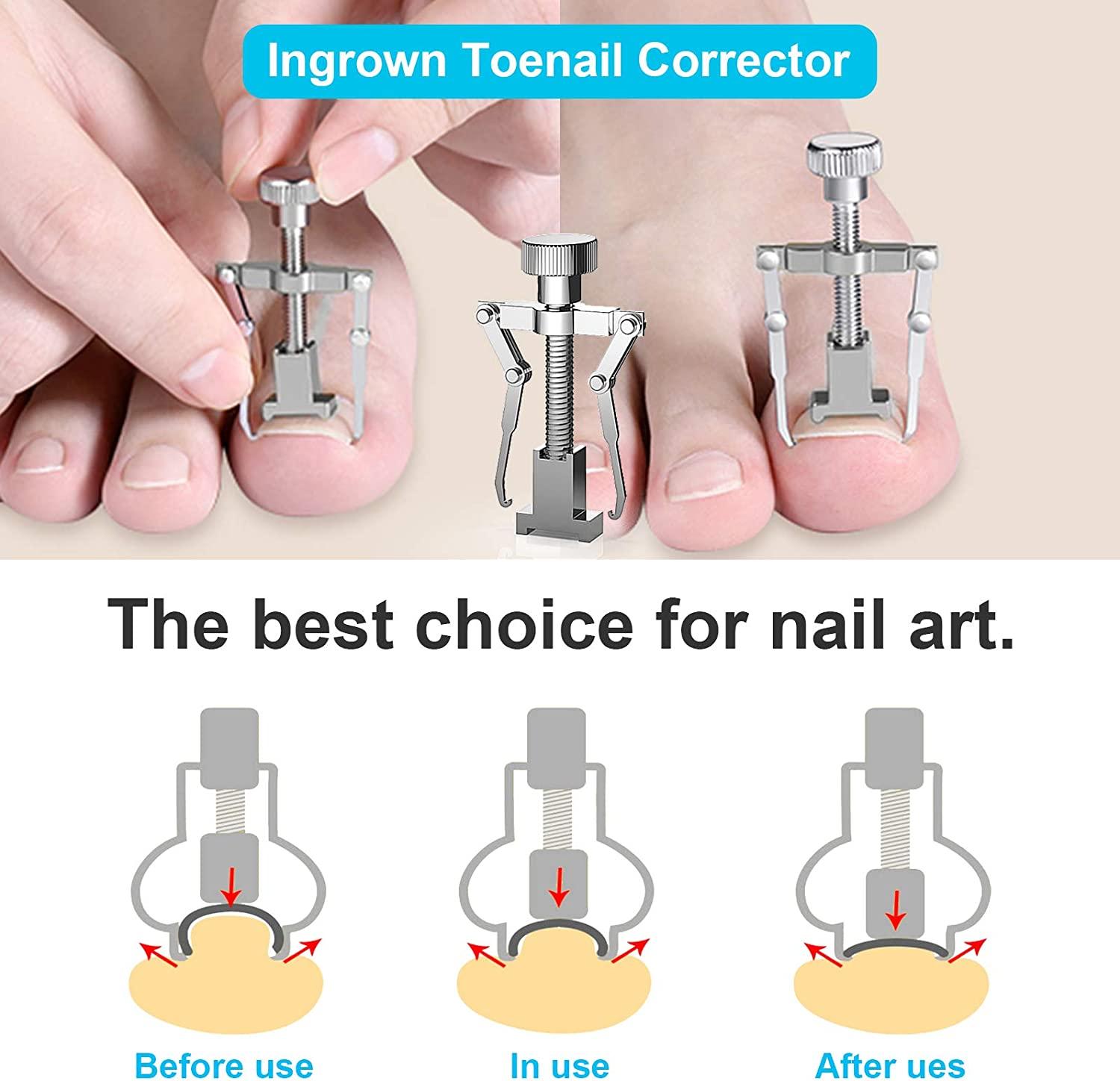 Professional Ingrown Toenail Treatment Kit 9pcs Podiatrist Clippers