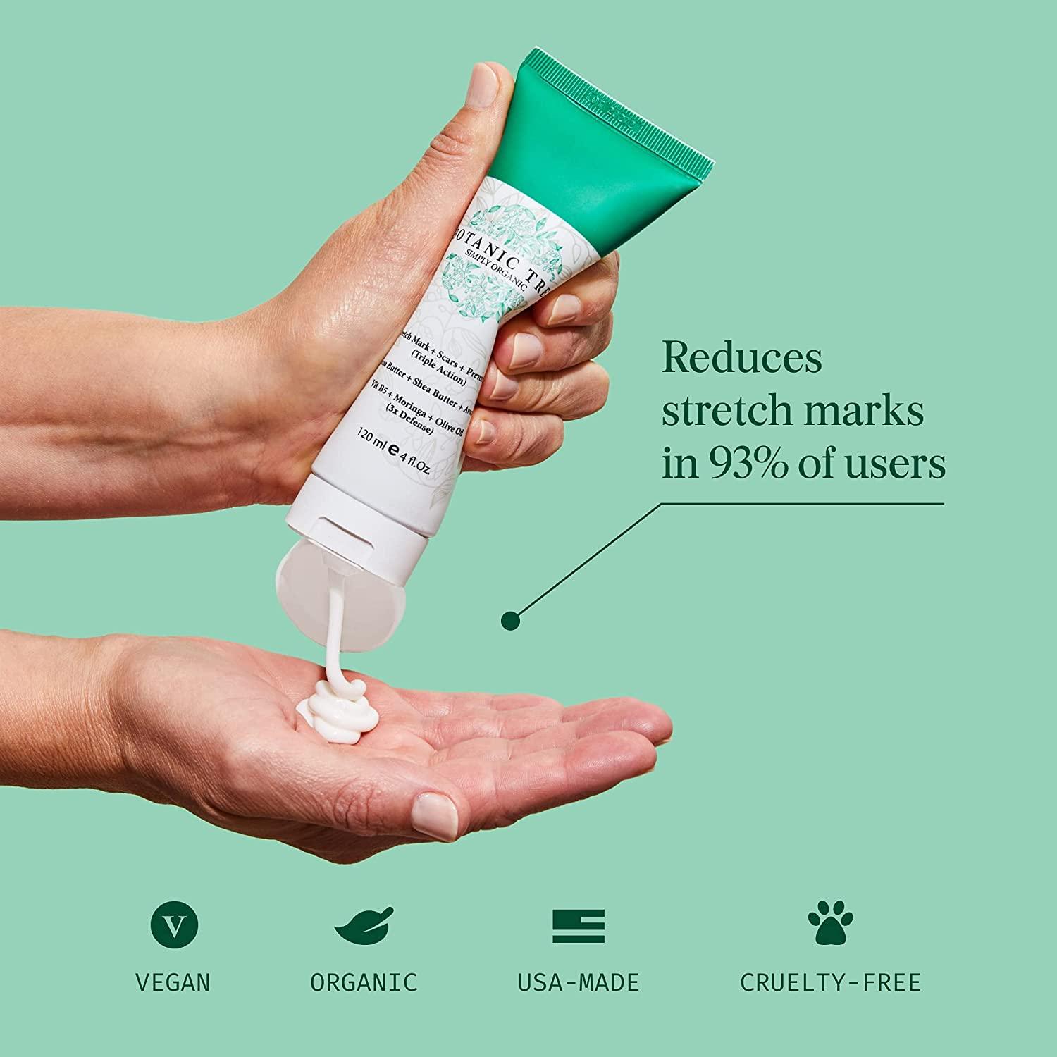 Botanic Tree Cocoa Butter Stretch Mark Cream for Pregnancy Belly