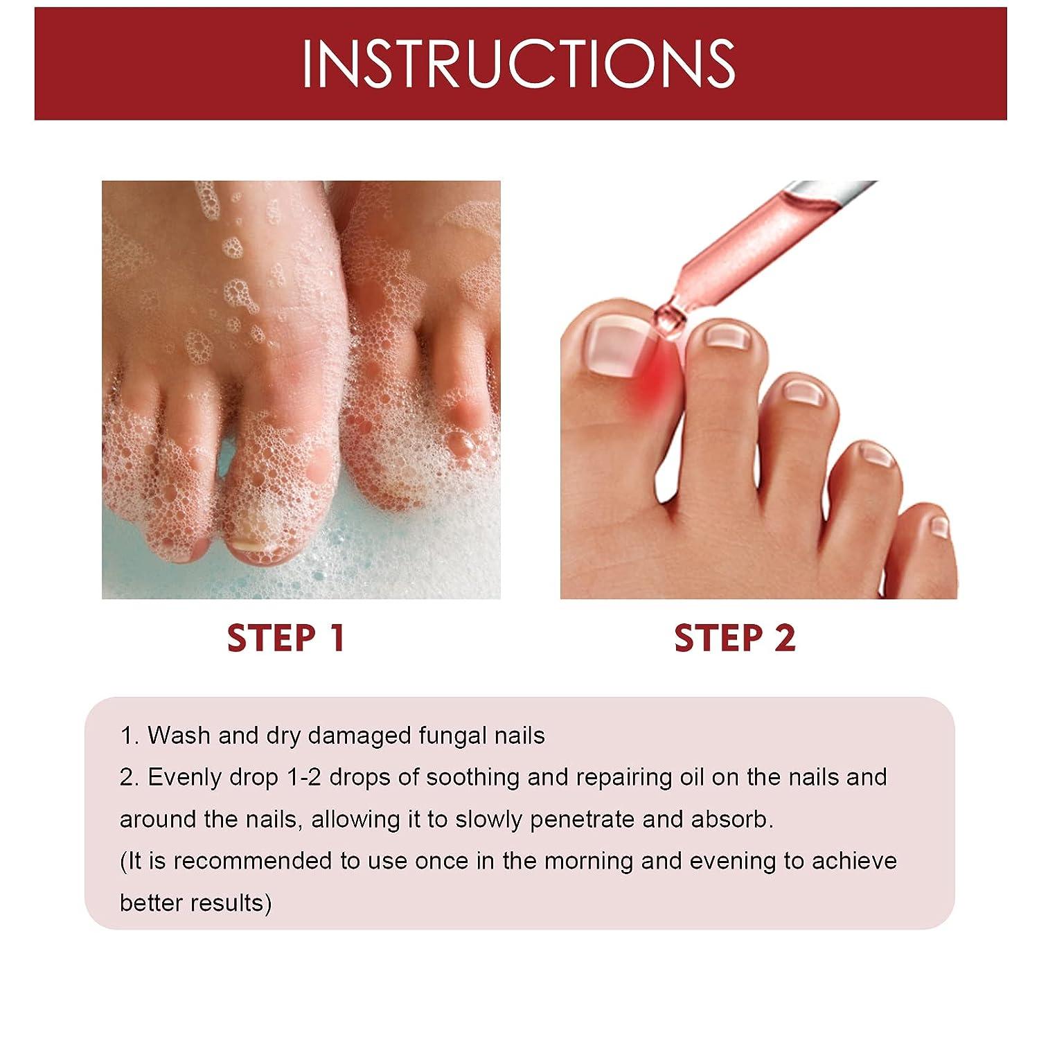 Understanding Top of Foot Pain: Causes, Symptoms & Treatment