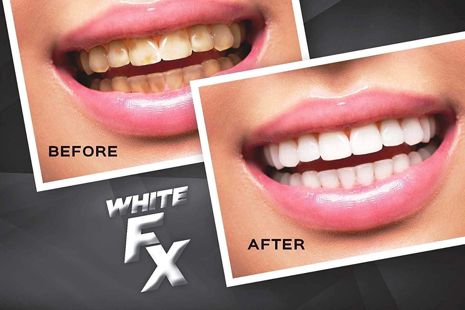 EverWhite Whitening . Effective Teeth Whitening Strips That Will