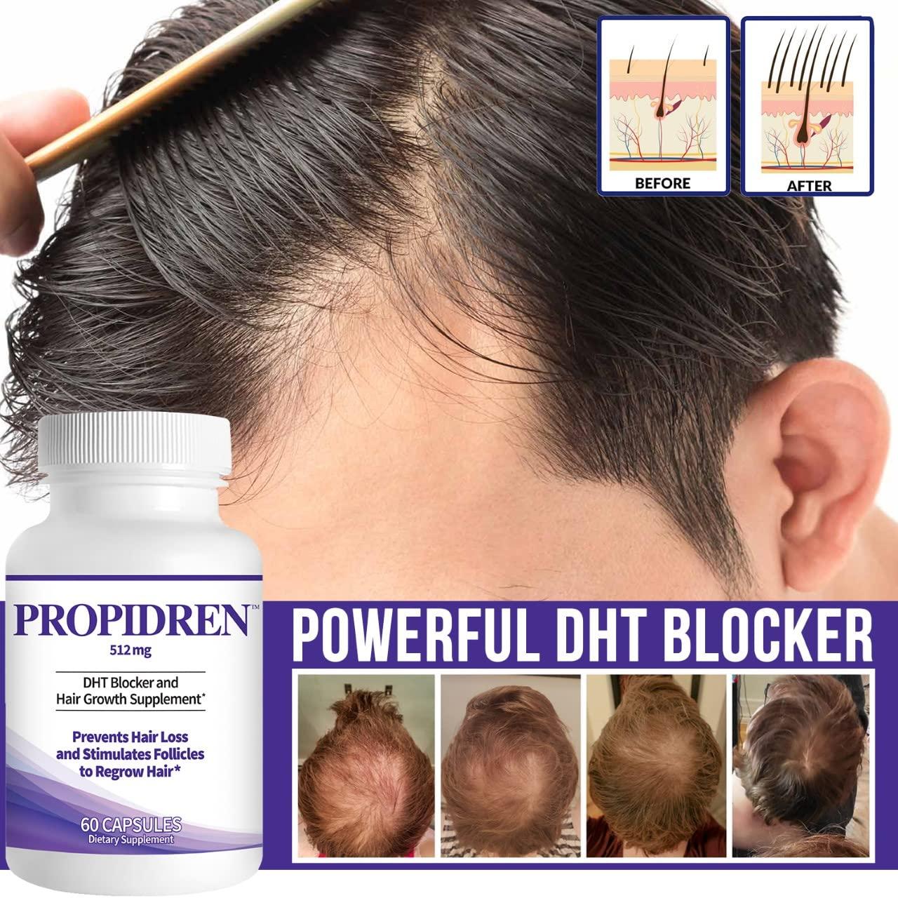 Propidren by HairGenics - DHT Blocker with Saw Palmetto To Prevent Hair  Loss and Stimulate Hair Follicles to Stop Hair Loss and Regrow Hair.