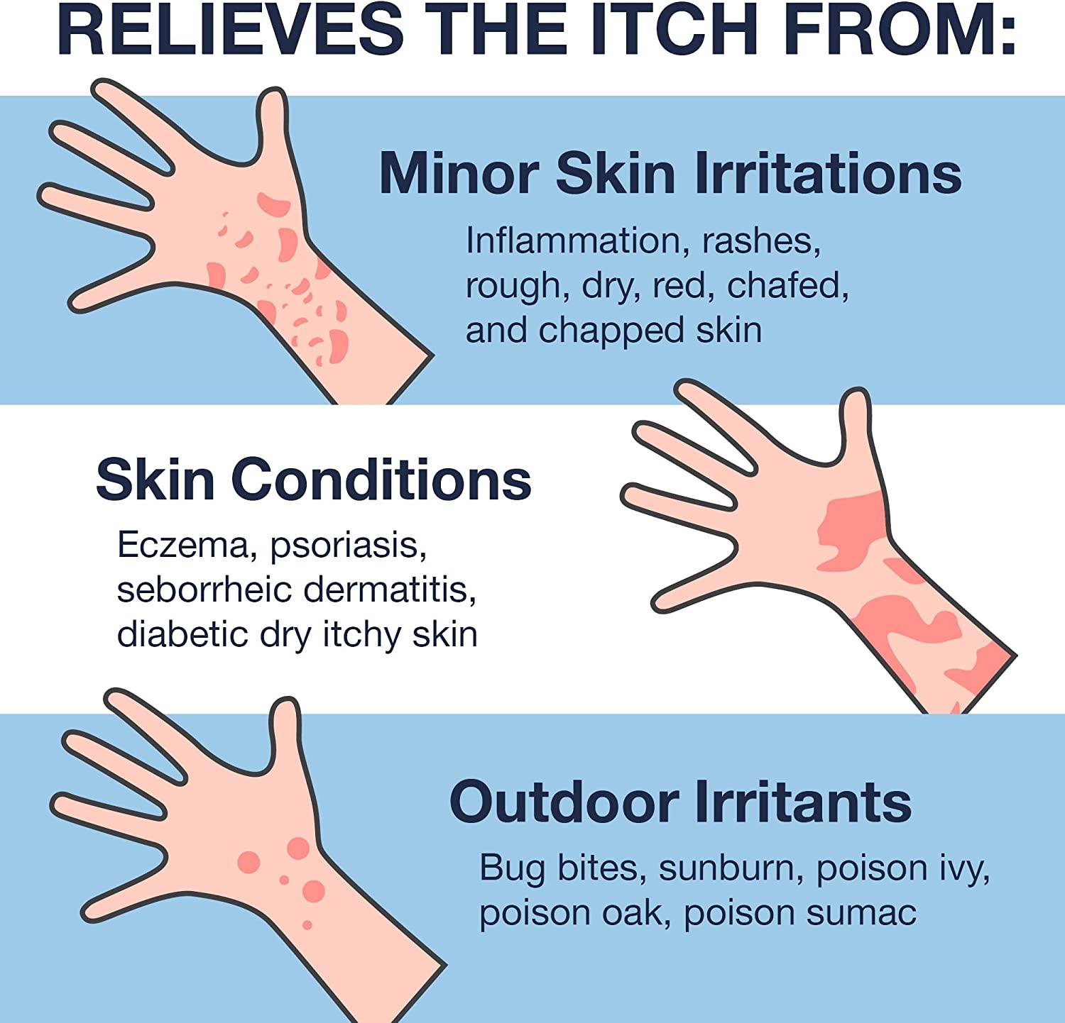 Hydrocortisone Ointment USP 1 1.05oz Maximum Strength AntiItch