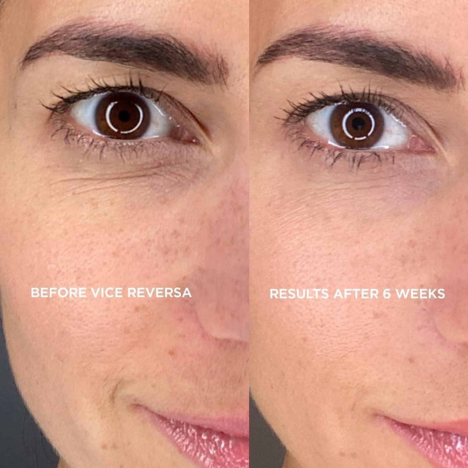 Vice Reversa Eye Rejuvenator Under Eye Patches with Hyaluronic Acid