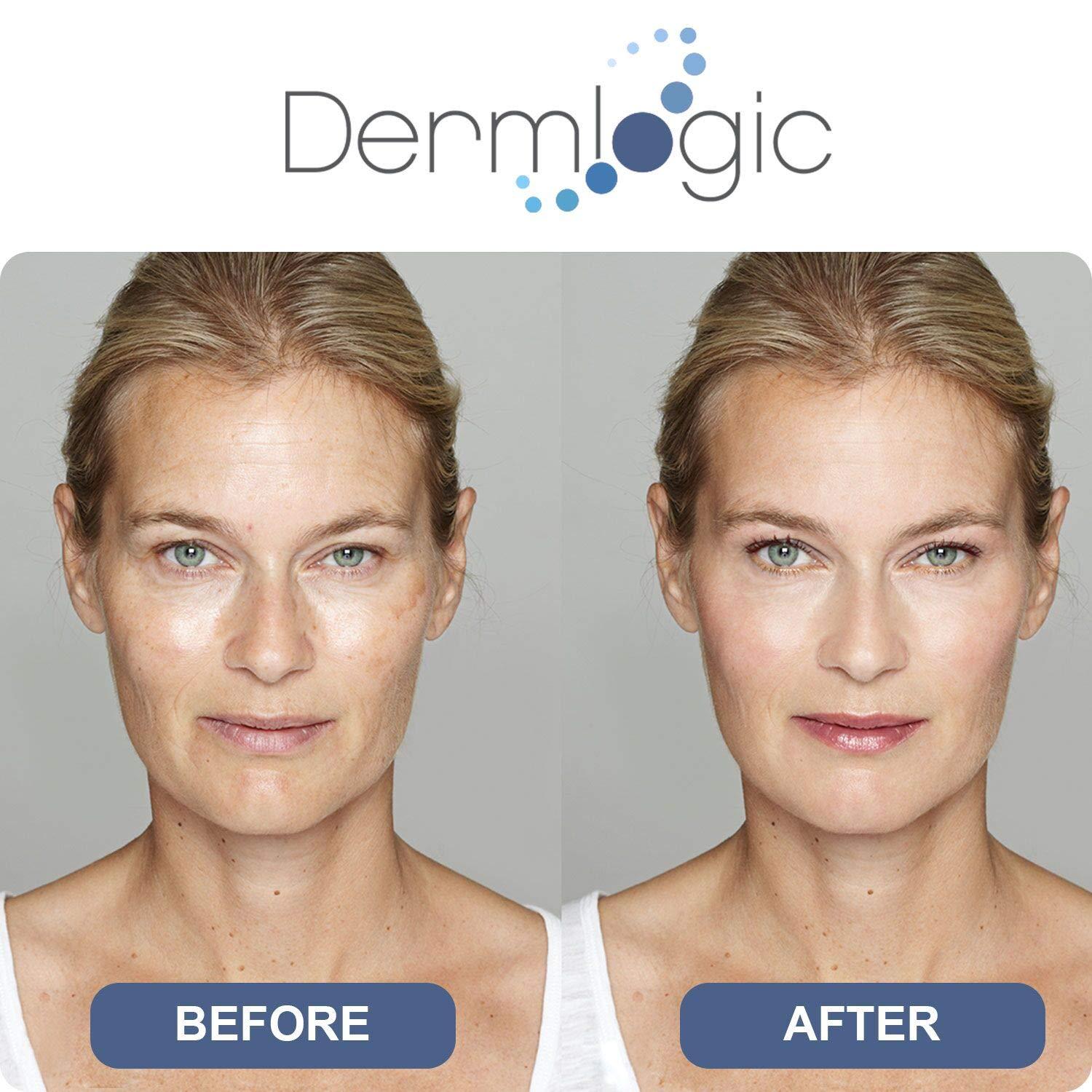 Dark Spot Corrector Cream Visibly Fades & Repairs Marks from Dark