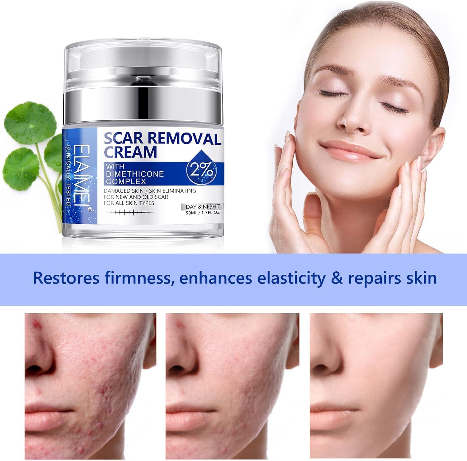 Scar Removal Cream for Old New Scars Skin Repair Gel for Surgical Acne C Section Marks