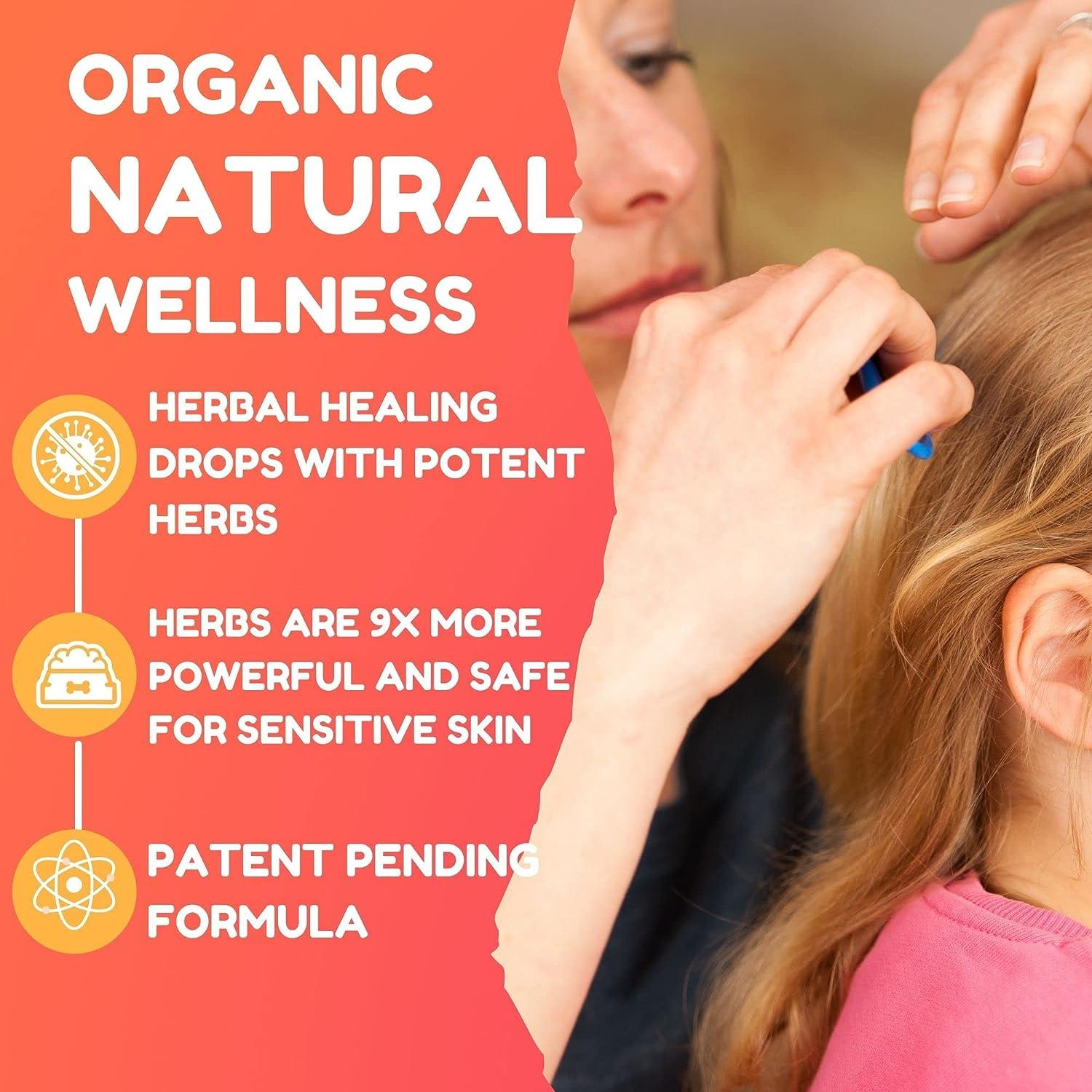 All Natural Lice Treatment. Powerful Herbs Infused Lice Treatment Extra