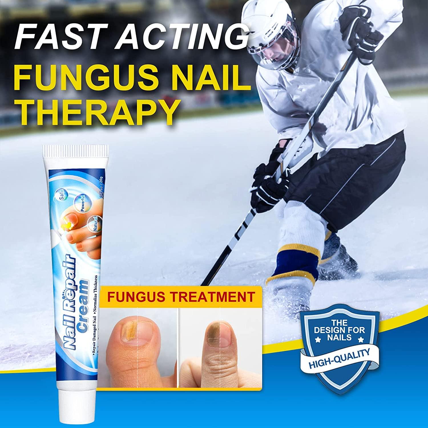 Maximum Strength Nail Repair Cream for Toenail Fungus Treatment 20g