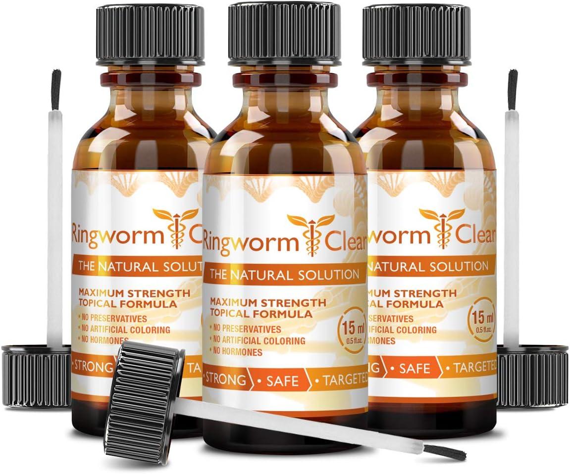 Ringworm Clear Natural Antifungal Treatment for Itching & Burning Prevents Future
