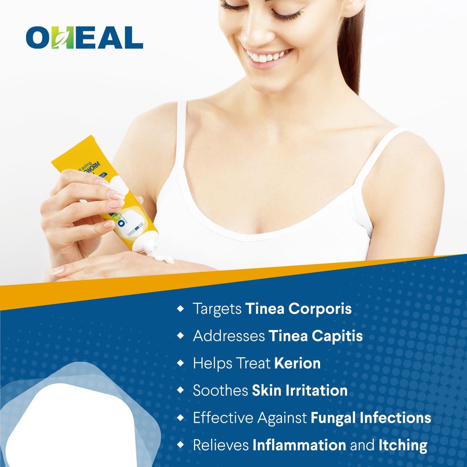 OHEAL Fast Acting Ringworm Treatment for Humans Tinea Versicolor