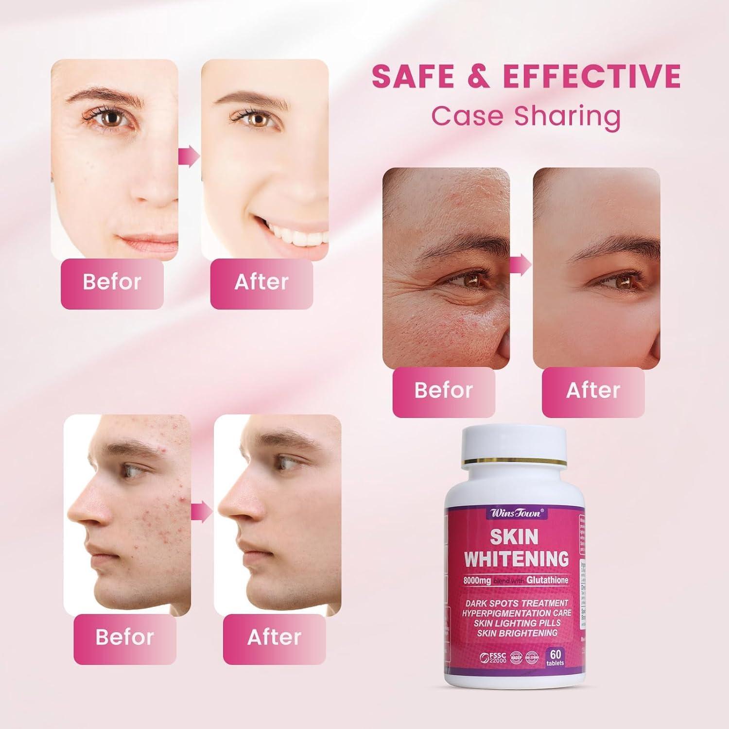 numbuzin 5 glutathione serum Dapuu L-Glutathione Skin Whitening Pills - 8000mg Skin Lightening  Supplement Whitening Antioxidant Anti-Aging 60 Tablets | Buy Now with  Express International Delivery