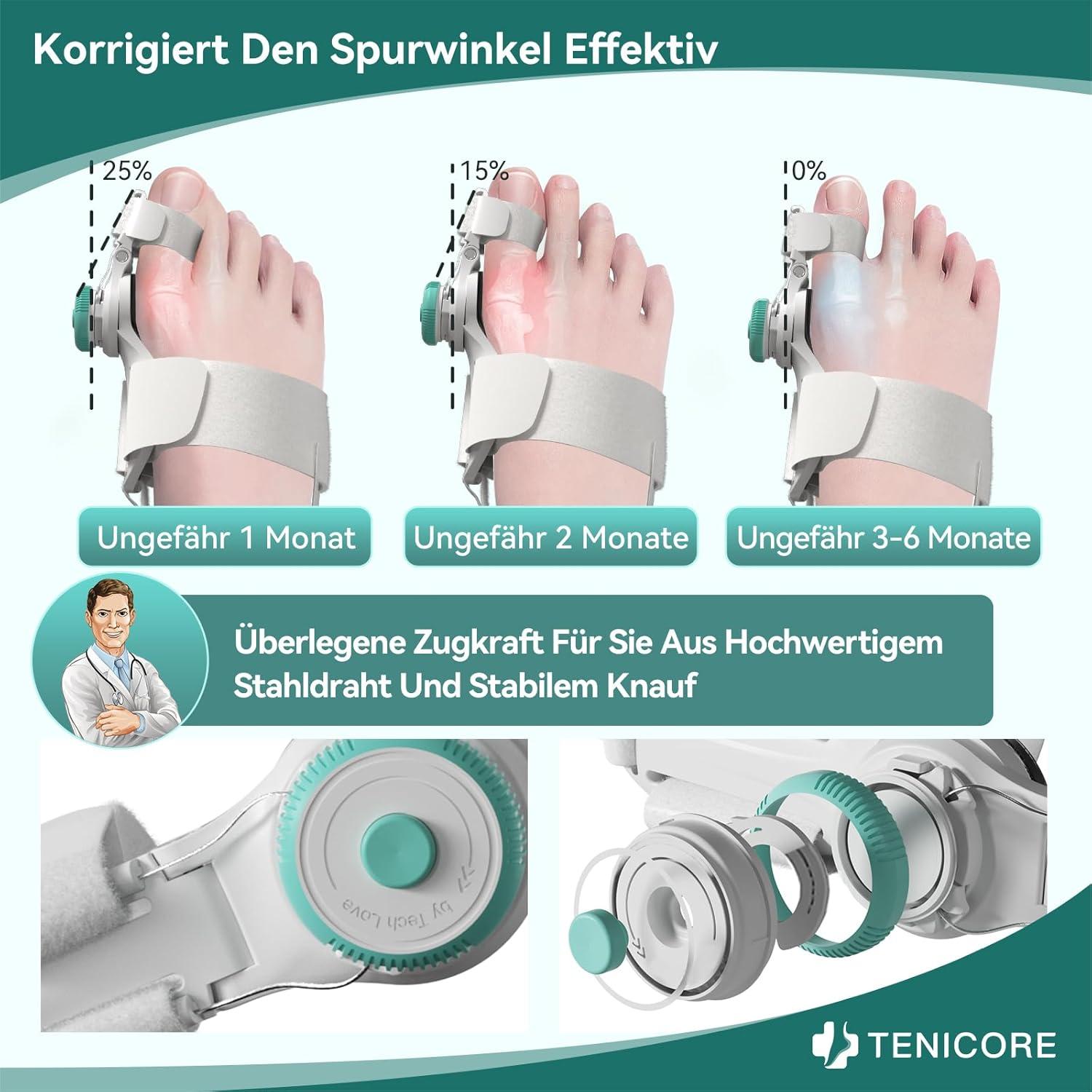 Hallux Valgus Schiene Von TENICORE - Einstellbarer Zehenkorrektor Für Männer & Frauen