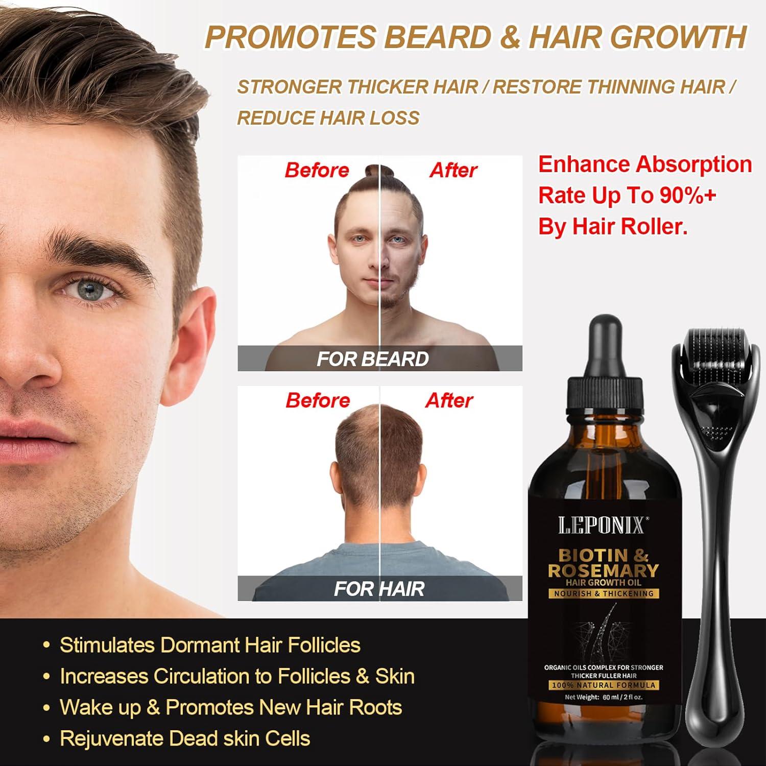 Rosemary Biotin Hair Growth Oil - Stimulates Regrowth & Strengthens Hair | Ideal For - View #5