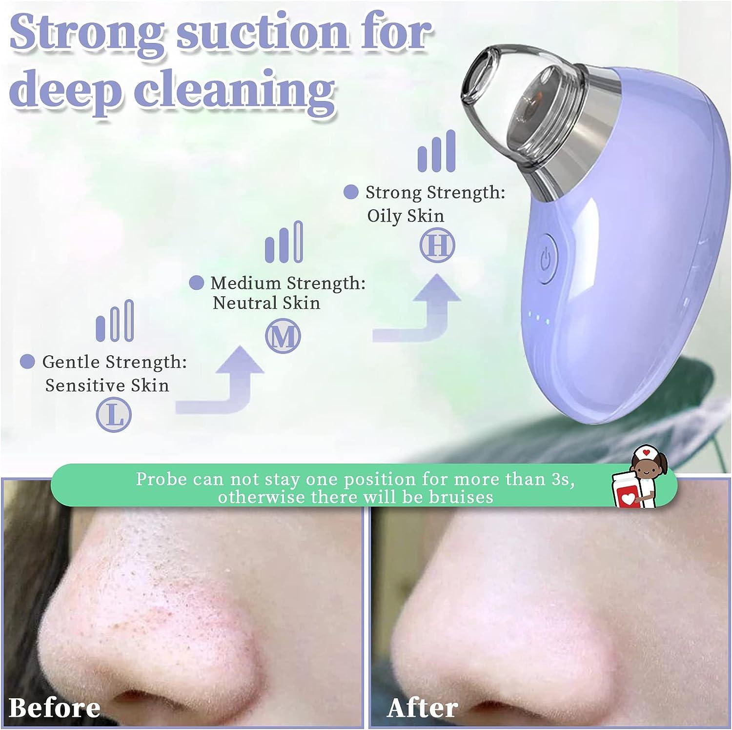 Professional Blackhead Remover Pore Vacuum with Camera - 3 Suction ...