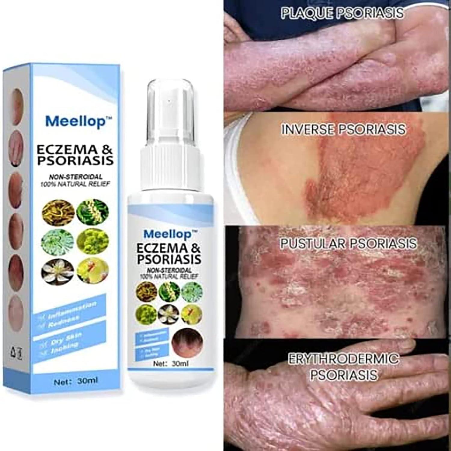 Meellop Herbal Psoriasis, Eczema, Vitiligo Relief Spray Skin Repair